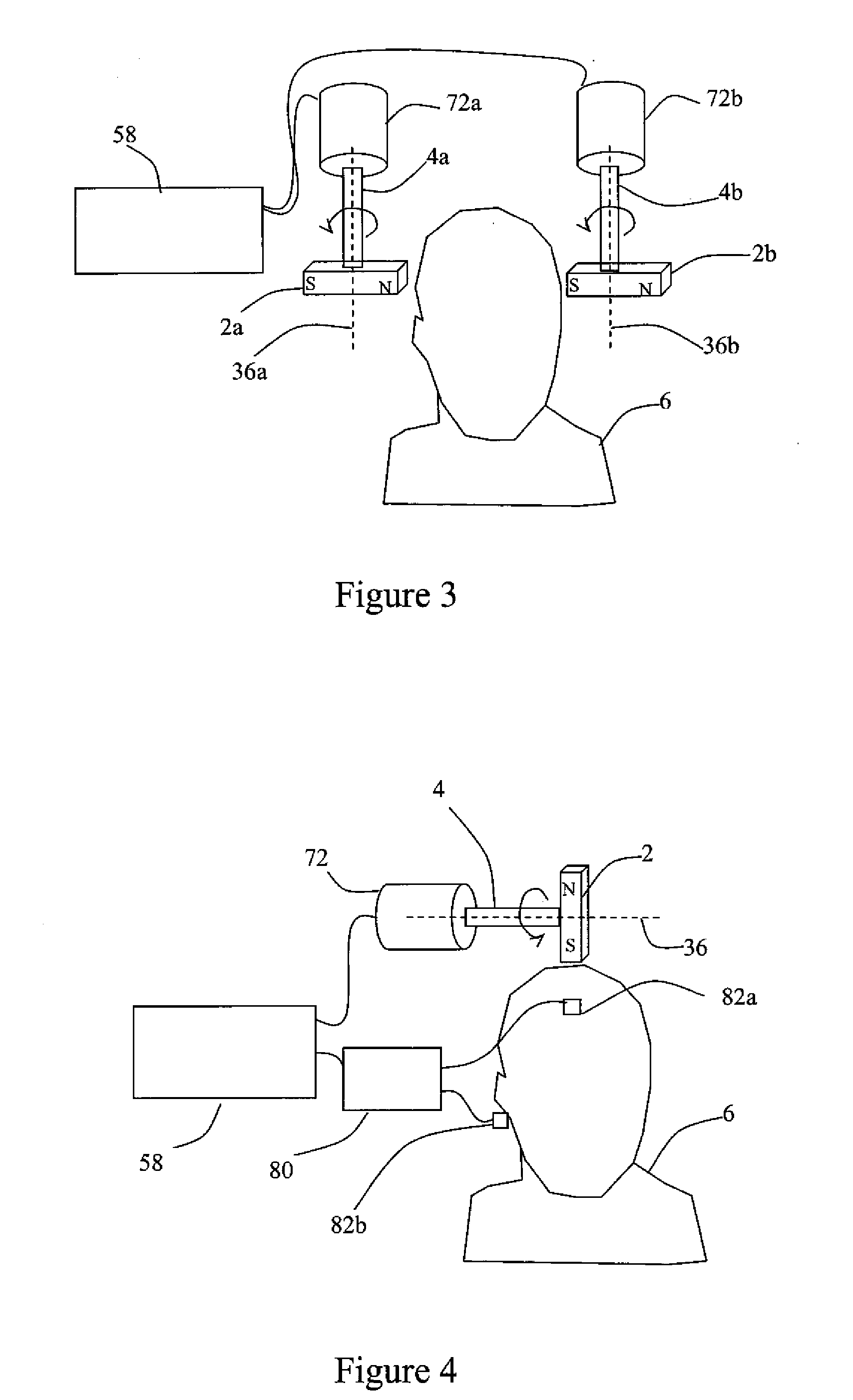 Systems and Methods for Depression Treatment Using Neuro-EEG Synchronization Therapy