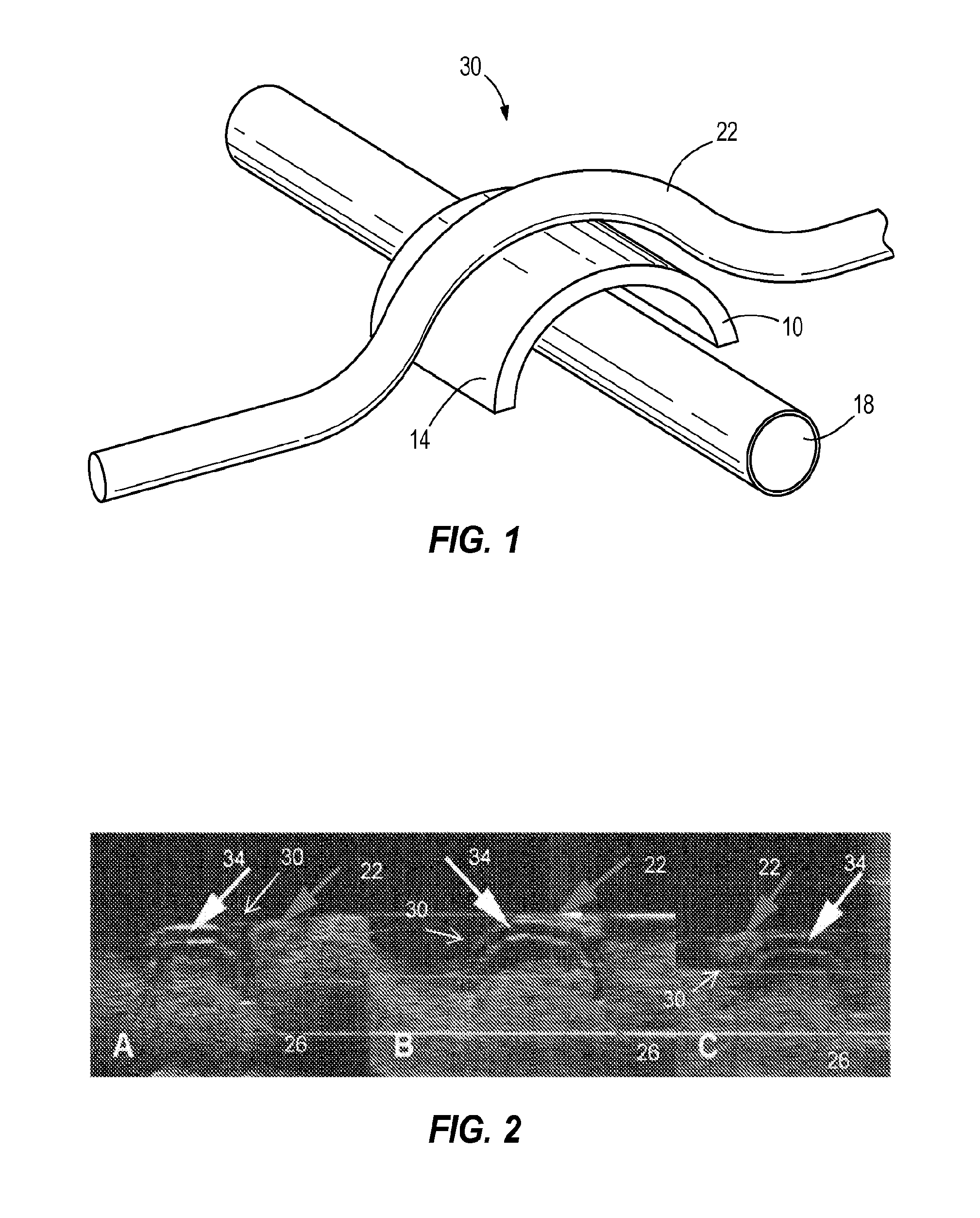 Apparatus and method for vascular and nerve separation and bridging