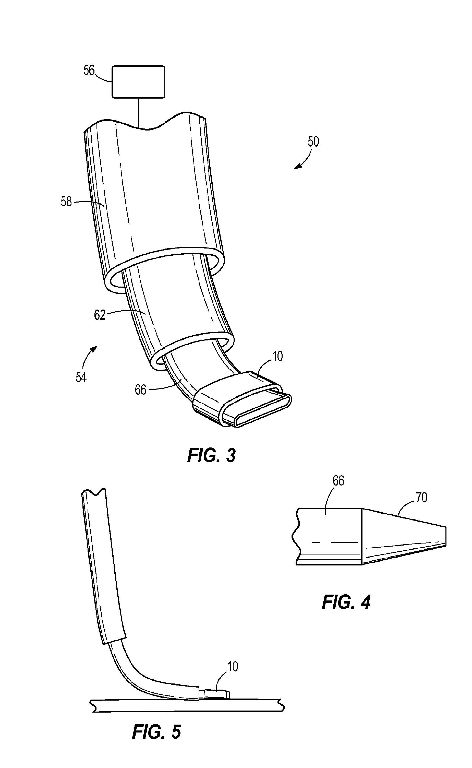 Apparatus and method for vascular and nerve separation and bridging