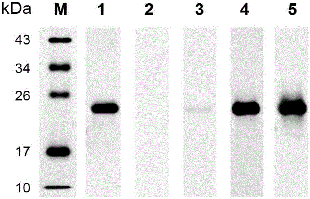 Schistosoma japonicum katsurada recombinant protein SjSAPLP4 as well as encoding gene and application thereof