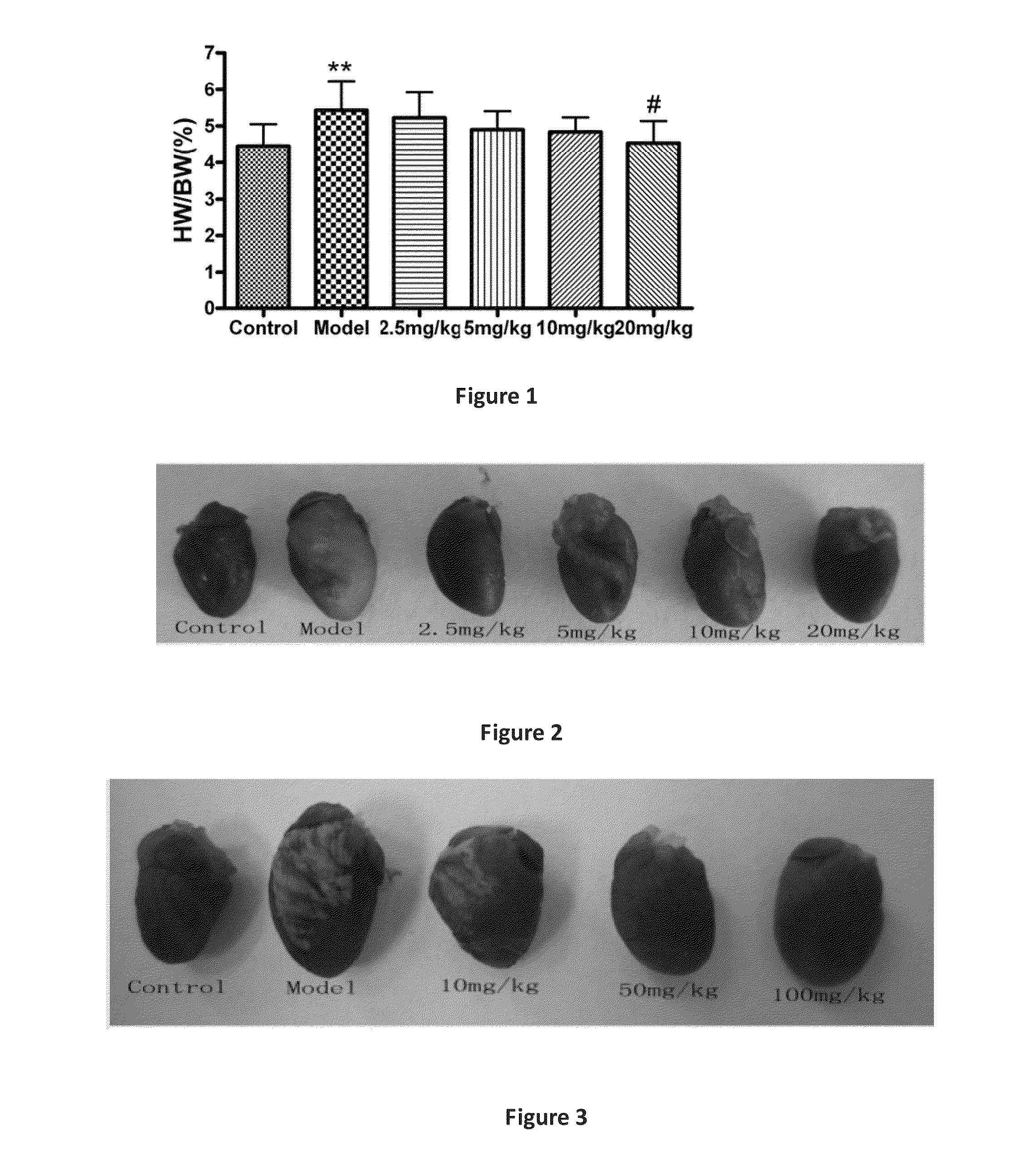 Line leaf inula flower lactone a and methods for preparing and using the same for treating myocarditis