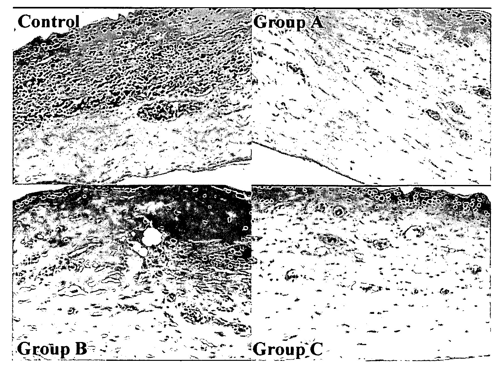 Composition for the prevention or treatment of diseases associated with angiogenesis