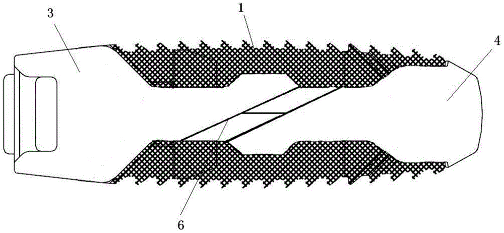 expandable interbody fusion cage