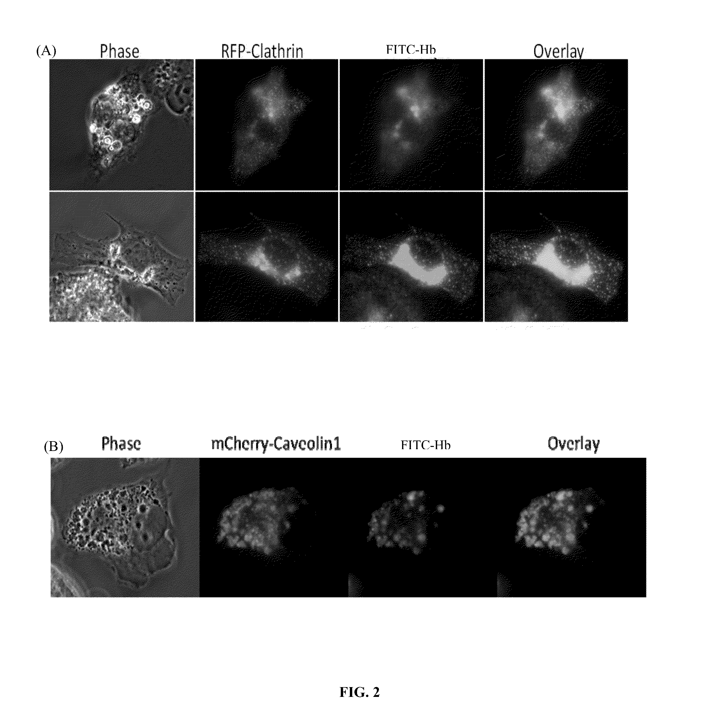 Hemoglobin-based oxygen carrier-containing pharmaceutical composition for cancer targeting treatment and prevention of cancer recurrence