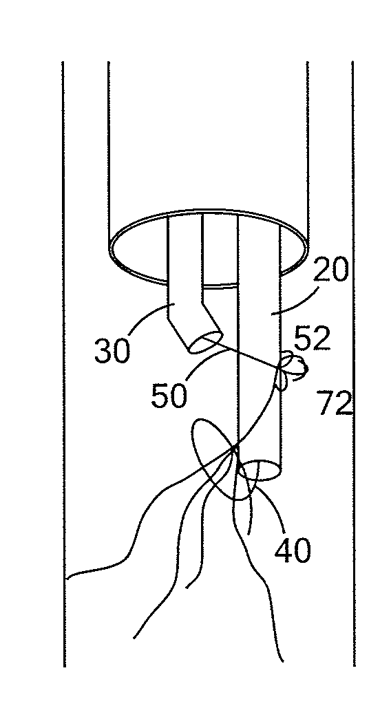 Spiral vena cava filter removal device