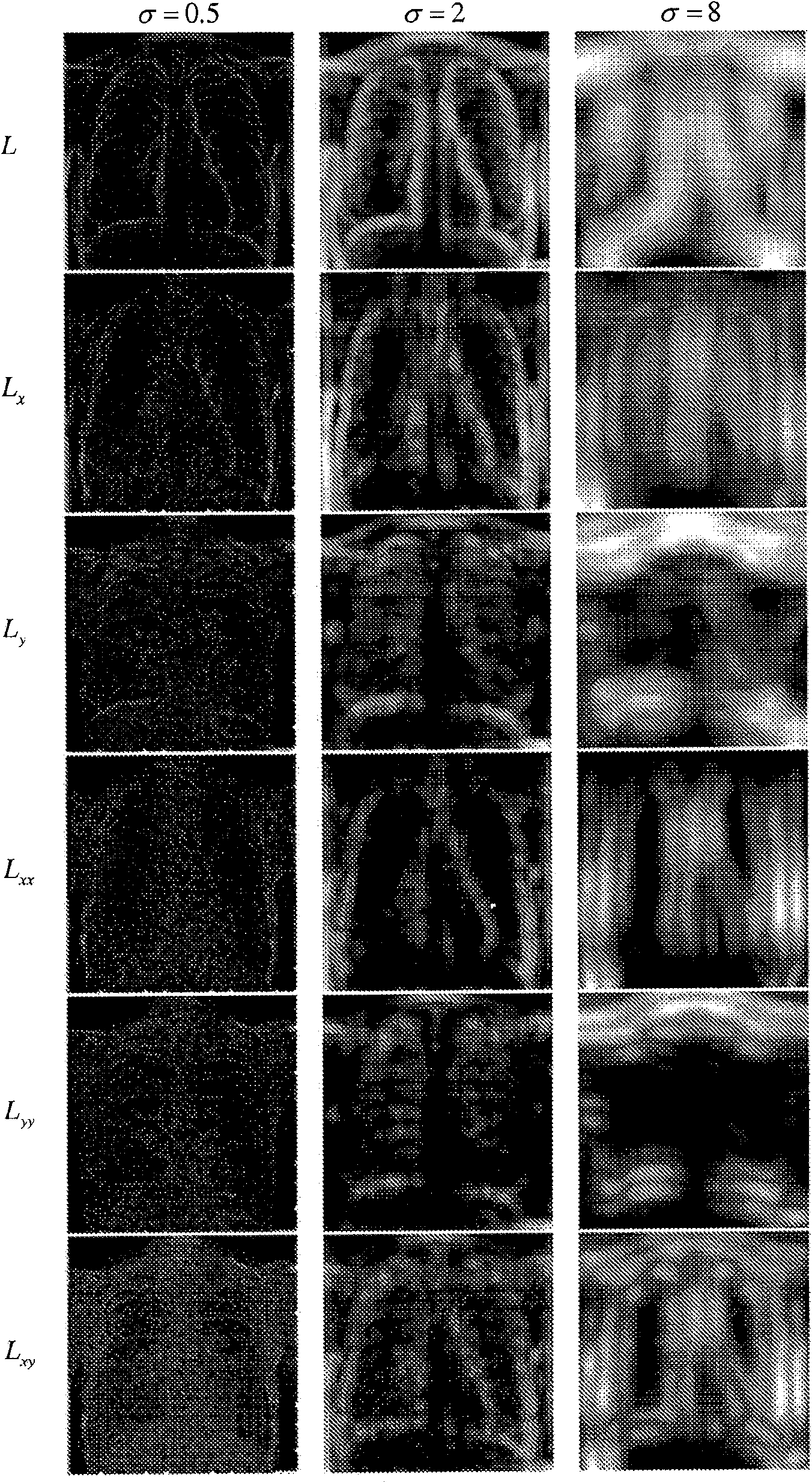 Method of segmenting anatomic entities in 3d digital medical images