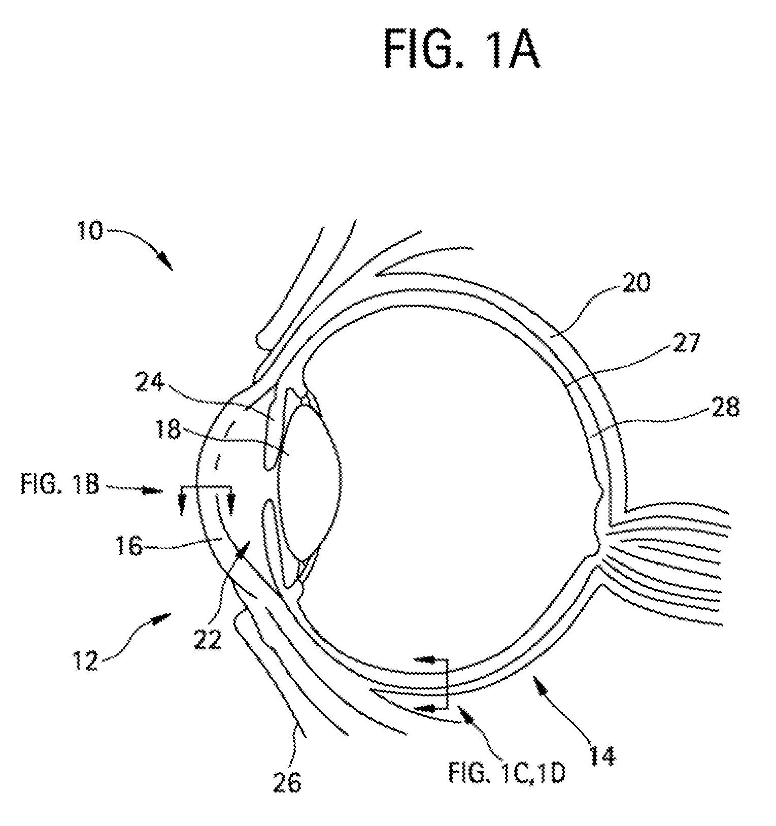 Methods and devices for drug delivery to ocular tissue using microneedle
