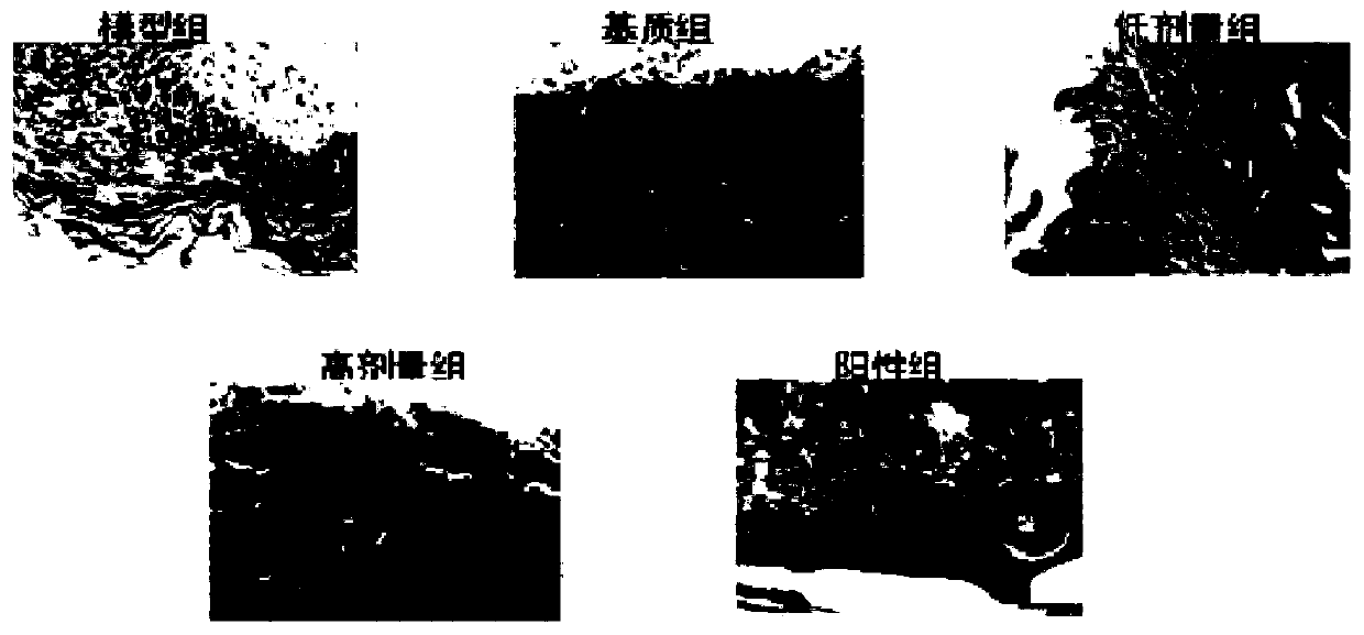 Traditional Chinese medicine compound hydrogel for skin wound treating and healing, and preparation method and application thereof
