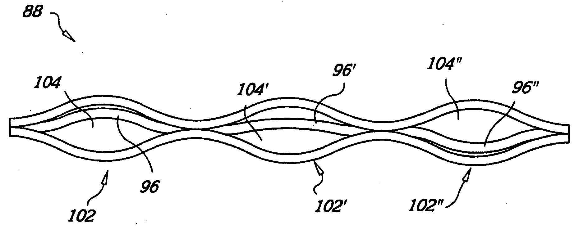 Radially expandable stents