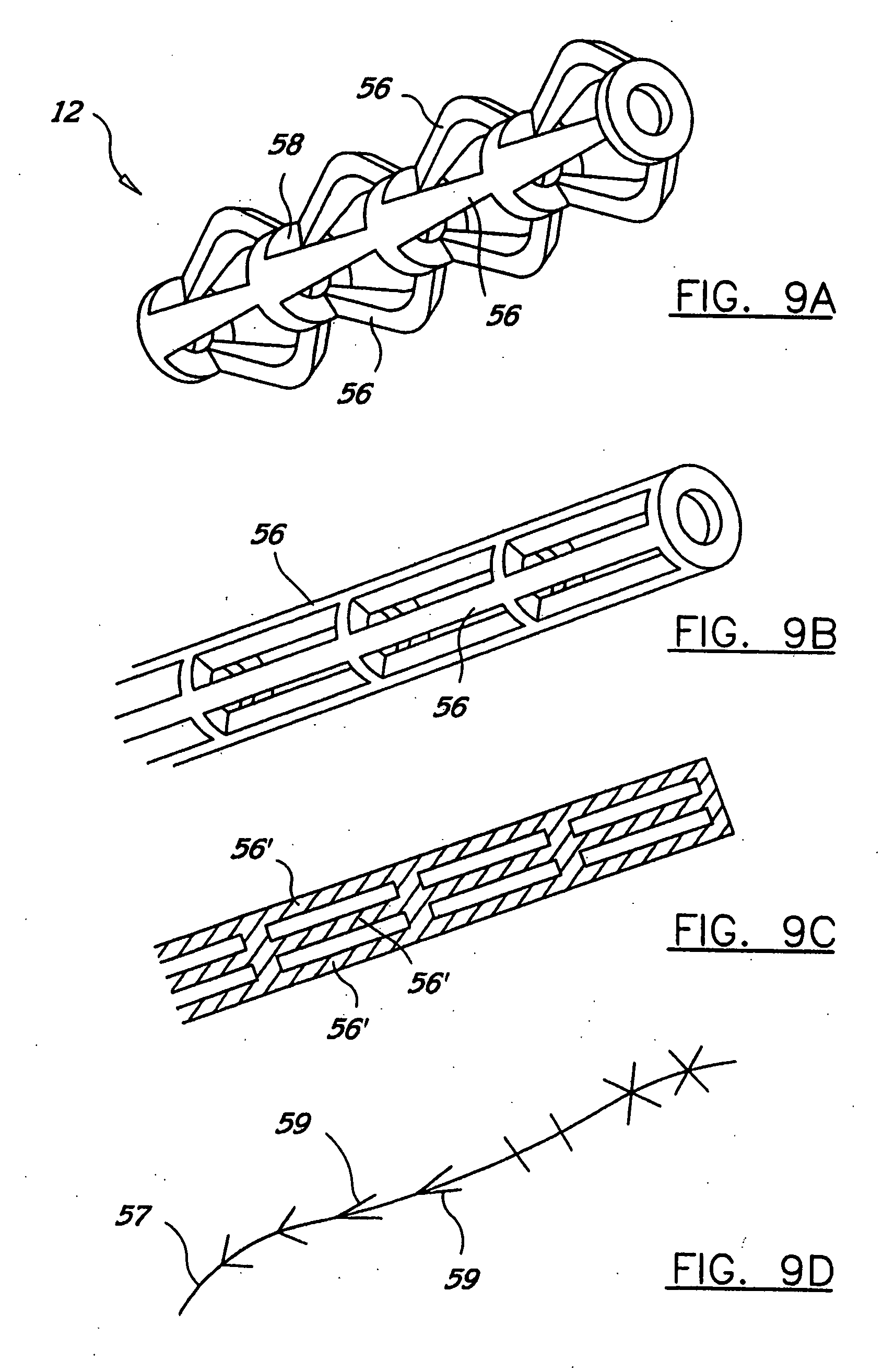 Radially expandable stents