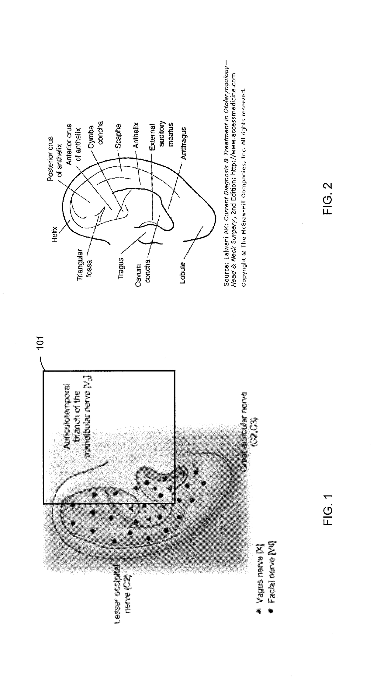 Methods and apparatuses for transdermal stimulation of the outer ear
