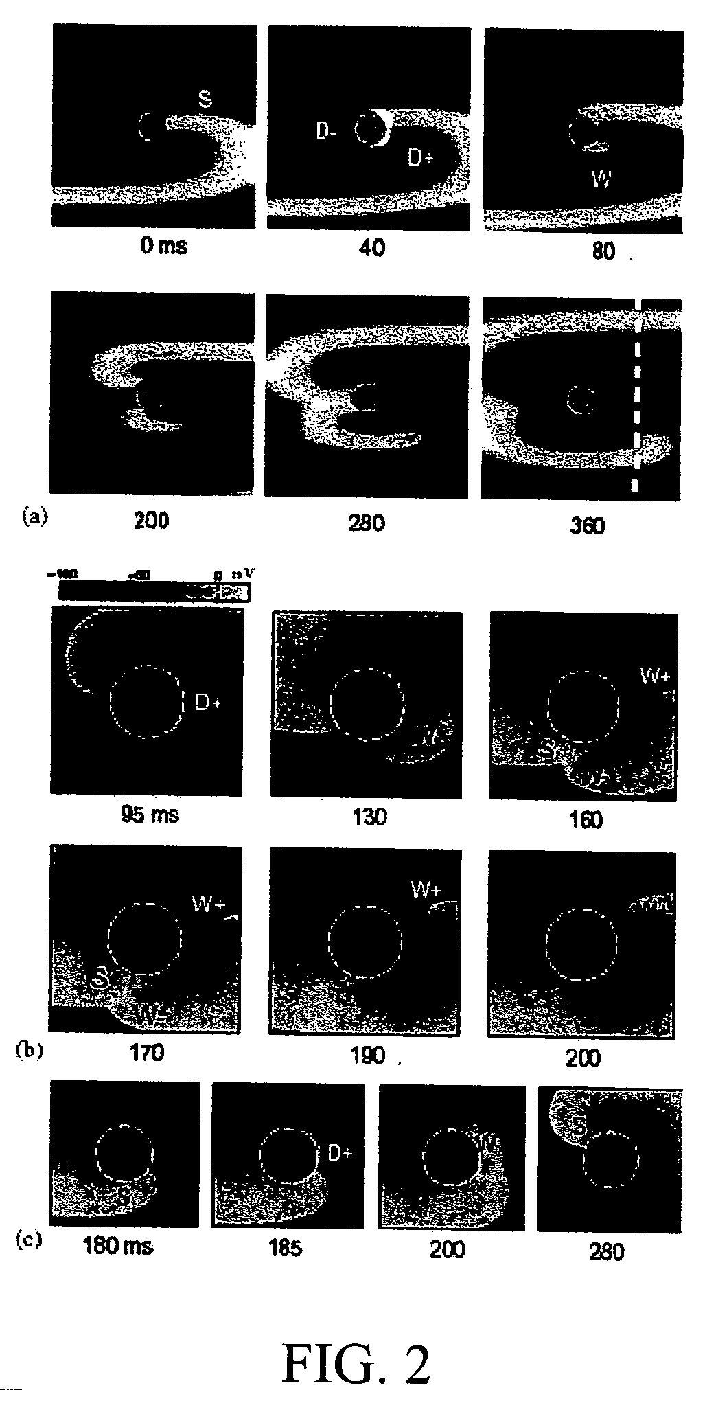 Method for low-voltage termination of cardiac arrhythmias by effectively unpinning anatomical reentries