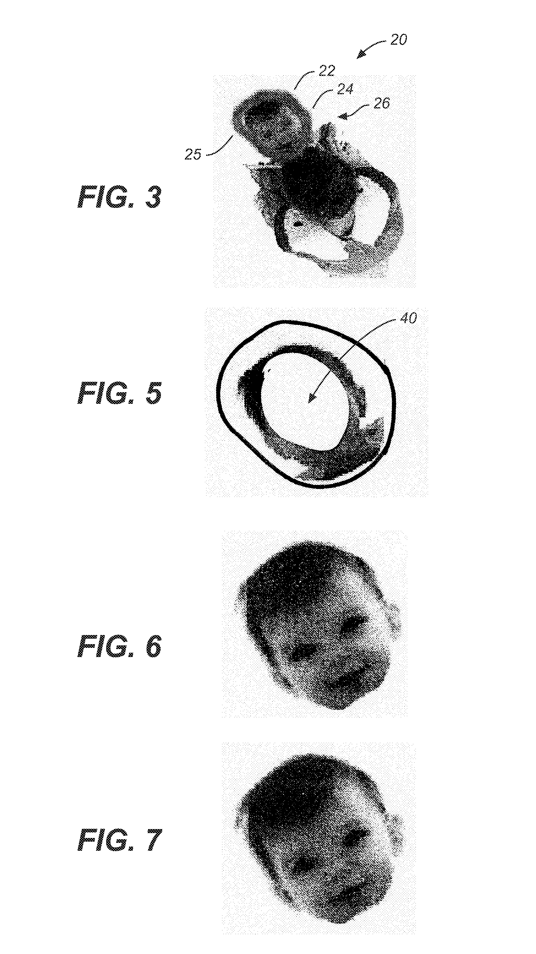 Identifying intrinsic pixel colors in a region of uncertain pixels