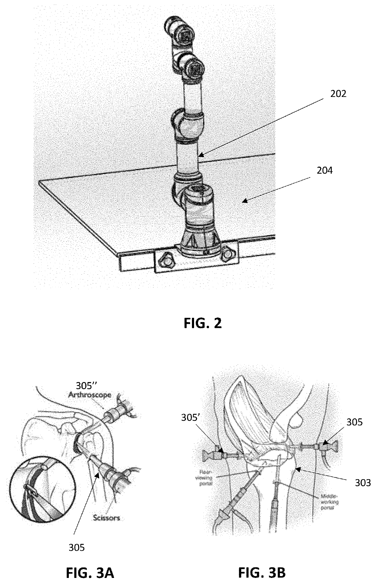 Robotic surgical methods and apparatuses