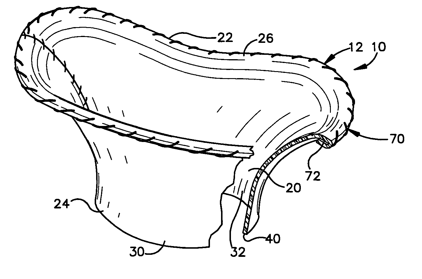 Method and apparatus for replacing a mitral valve with a stentless bioprosthetic valve