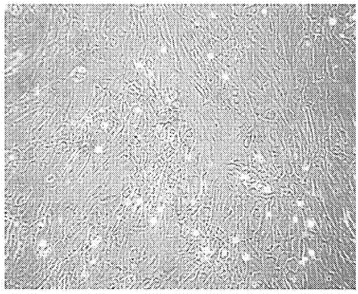 Human endometriosis cell