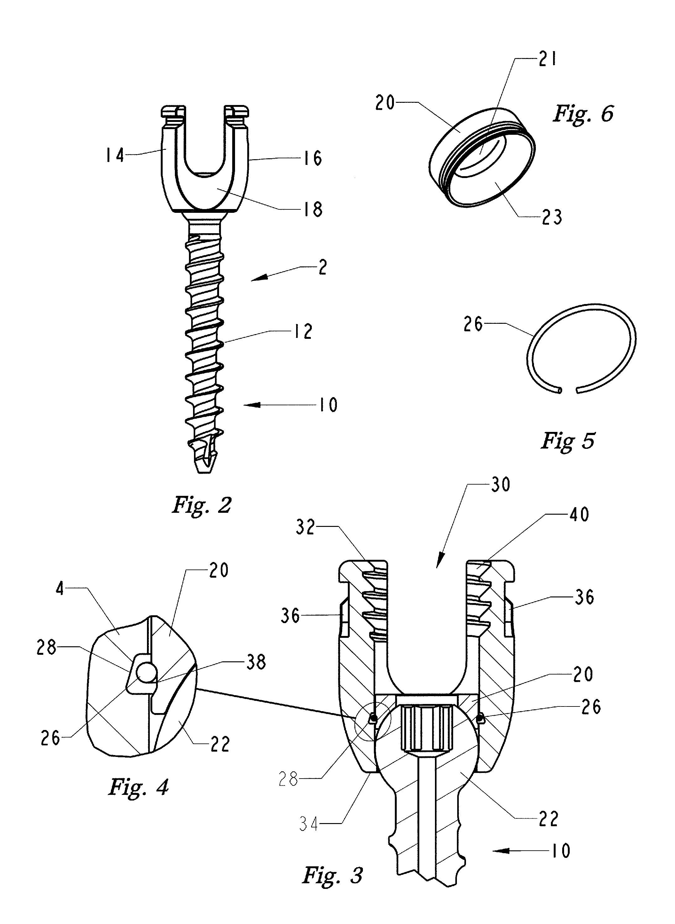 Top loading polyaxial ball and socket fastener with saddle