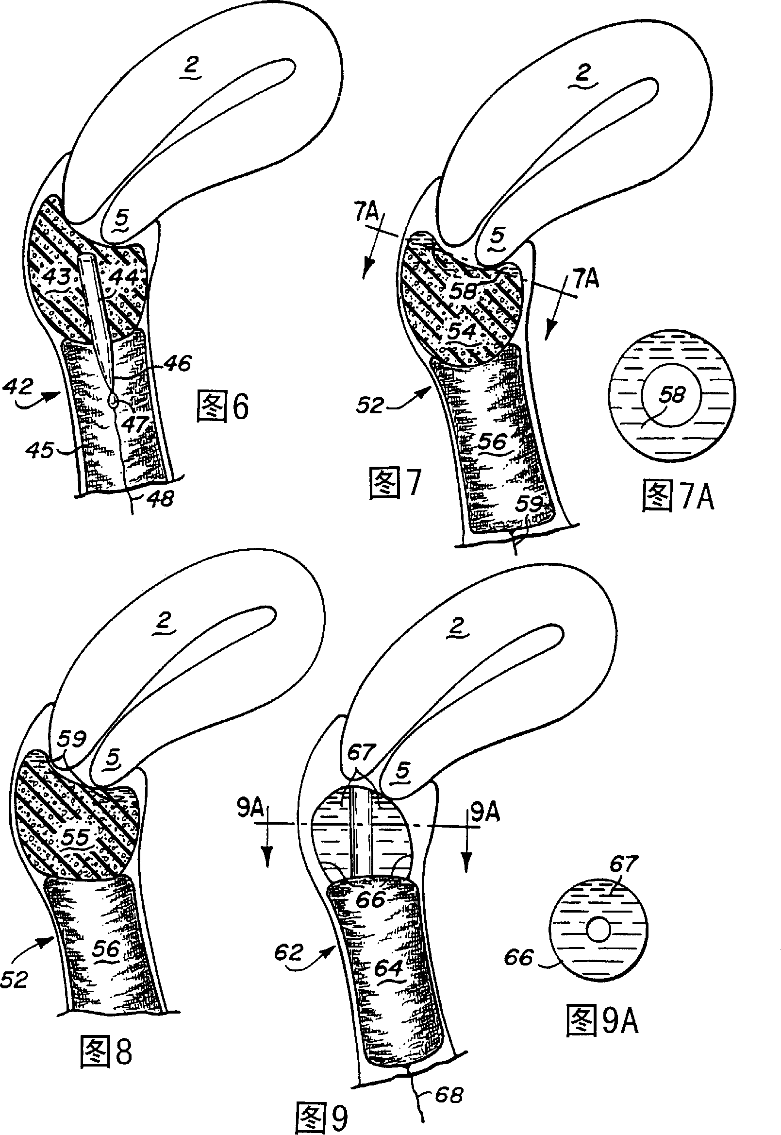 Device and method for treatment of dysmenorrhea