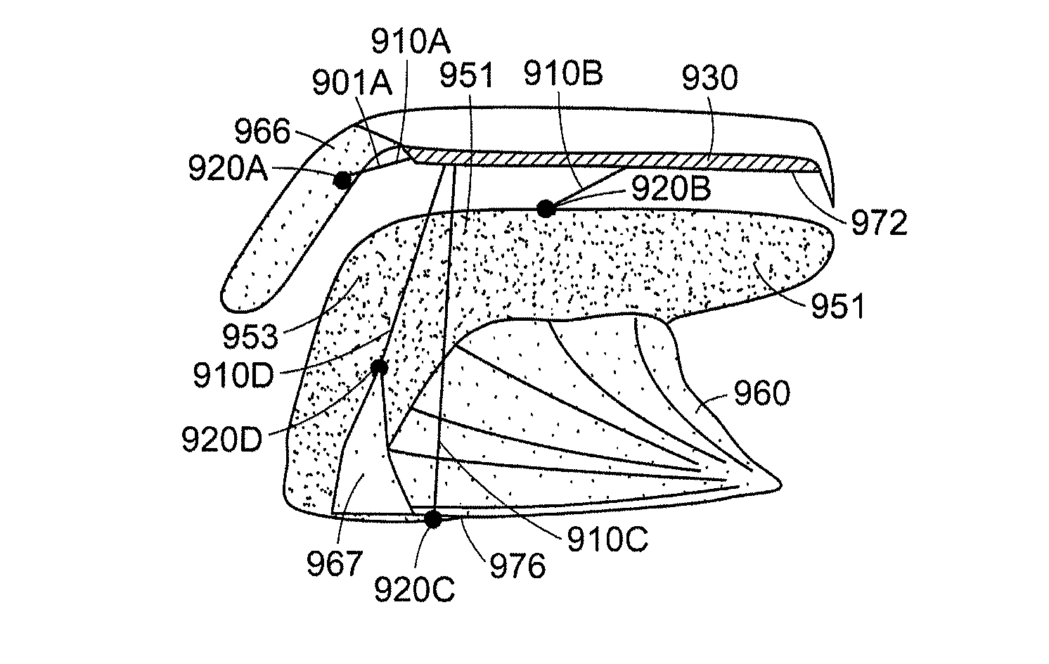 Methods and devices for treating sleep apnea and snoring