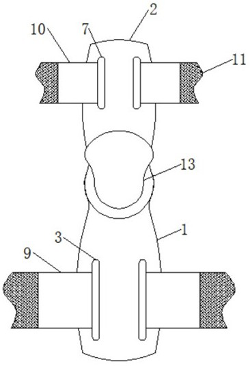 Hallux valgus corrector