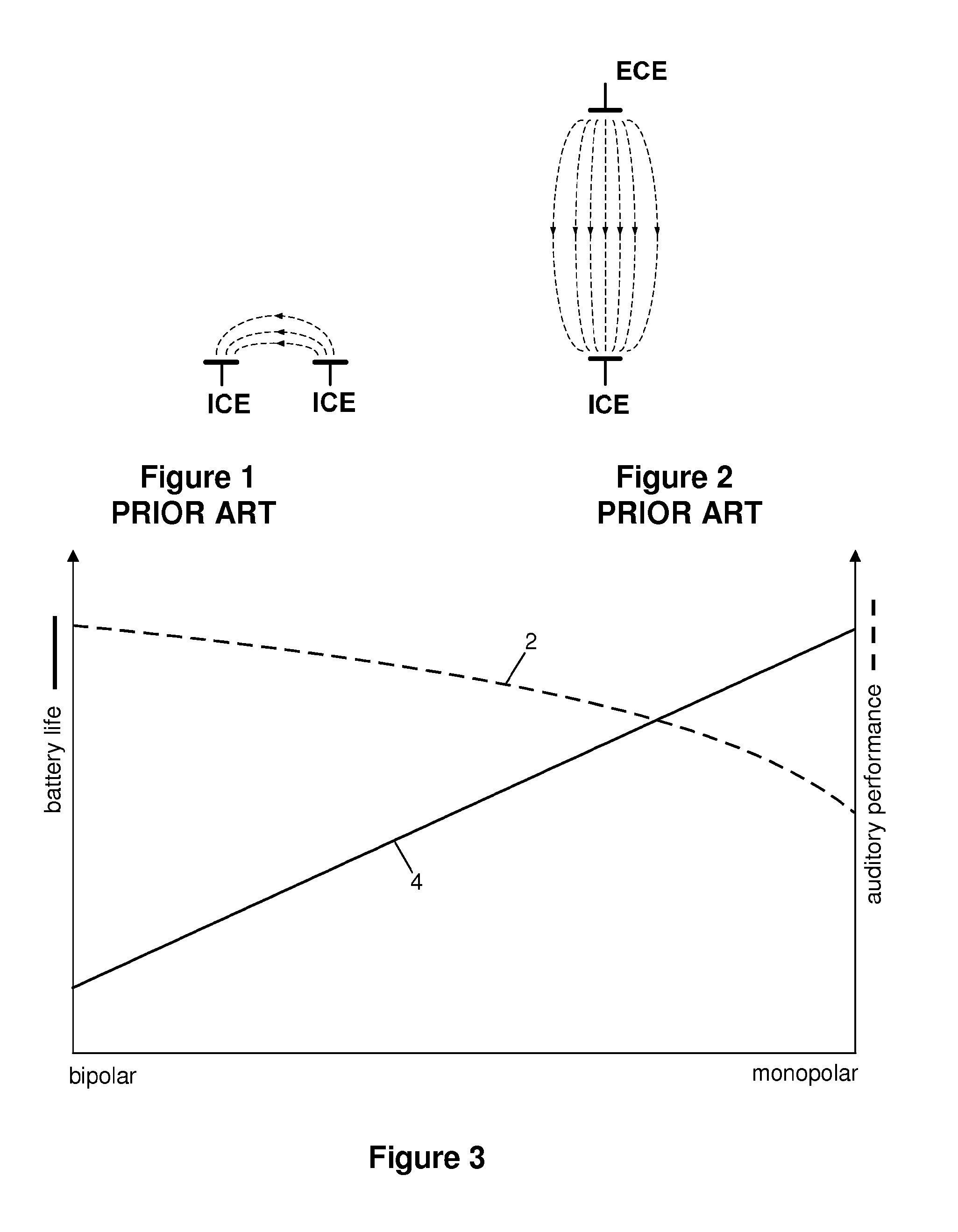 Implant stimulation device