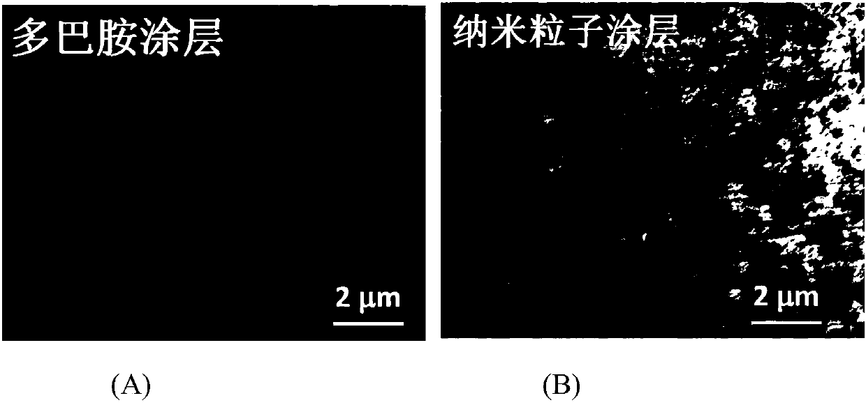 A kind of preparation method of copper ion chelating type nano particle biological coating