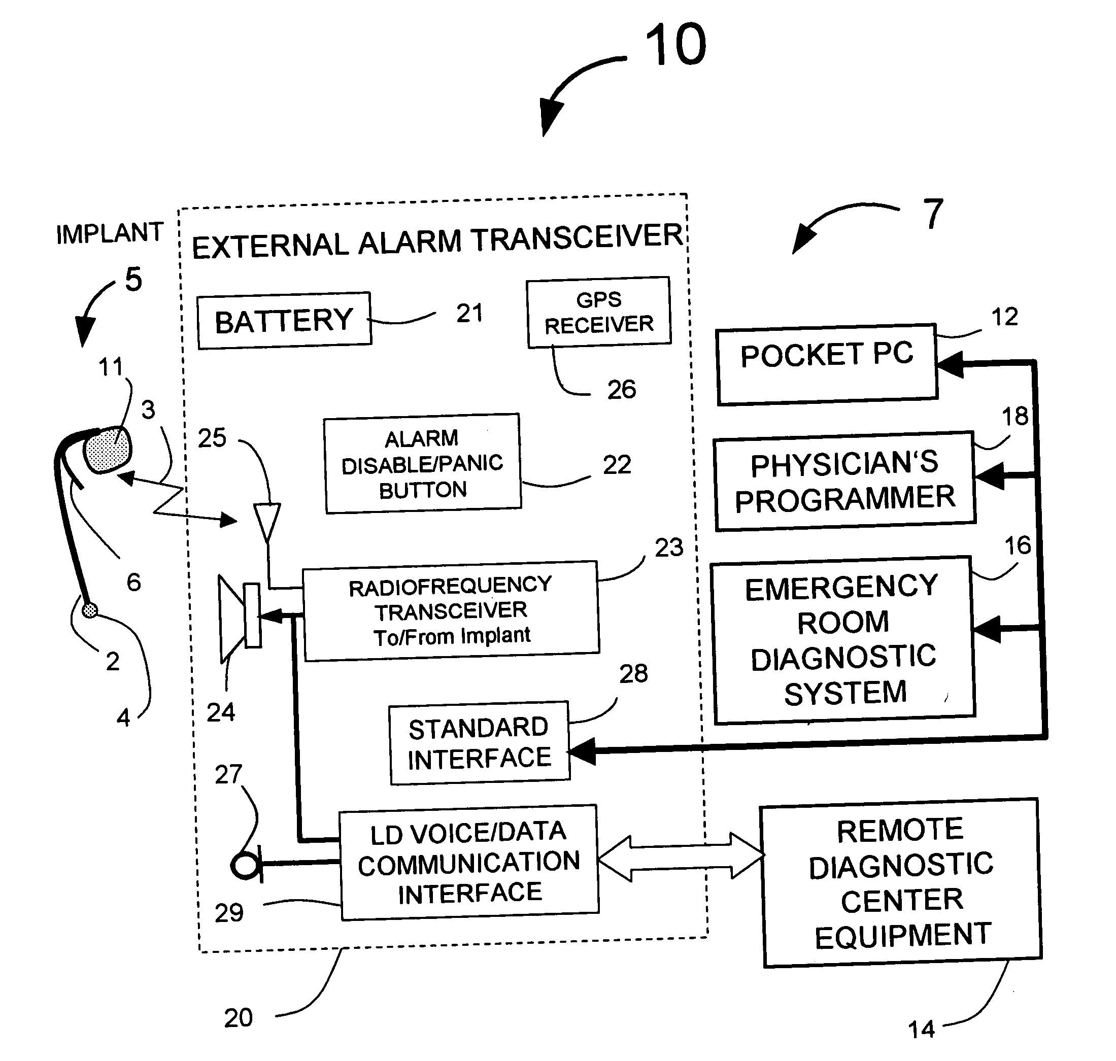 Electrogram signal filtering in systems for detecting ischemia