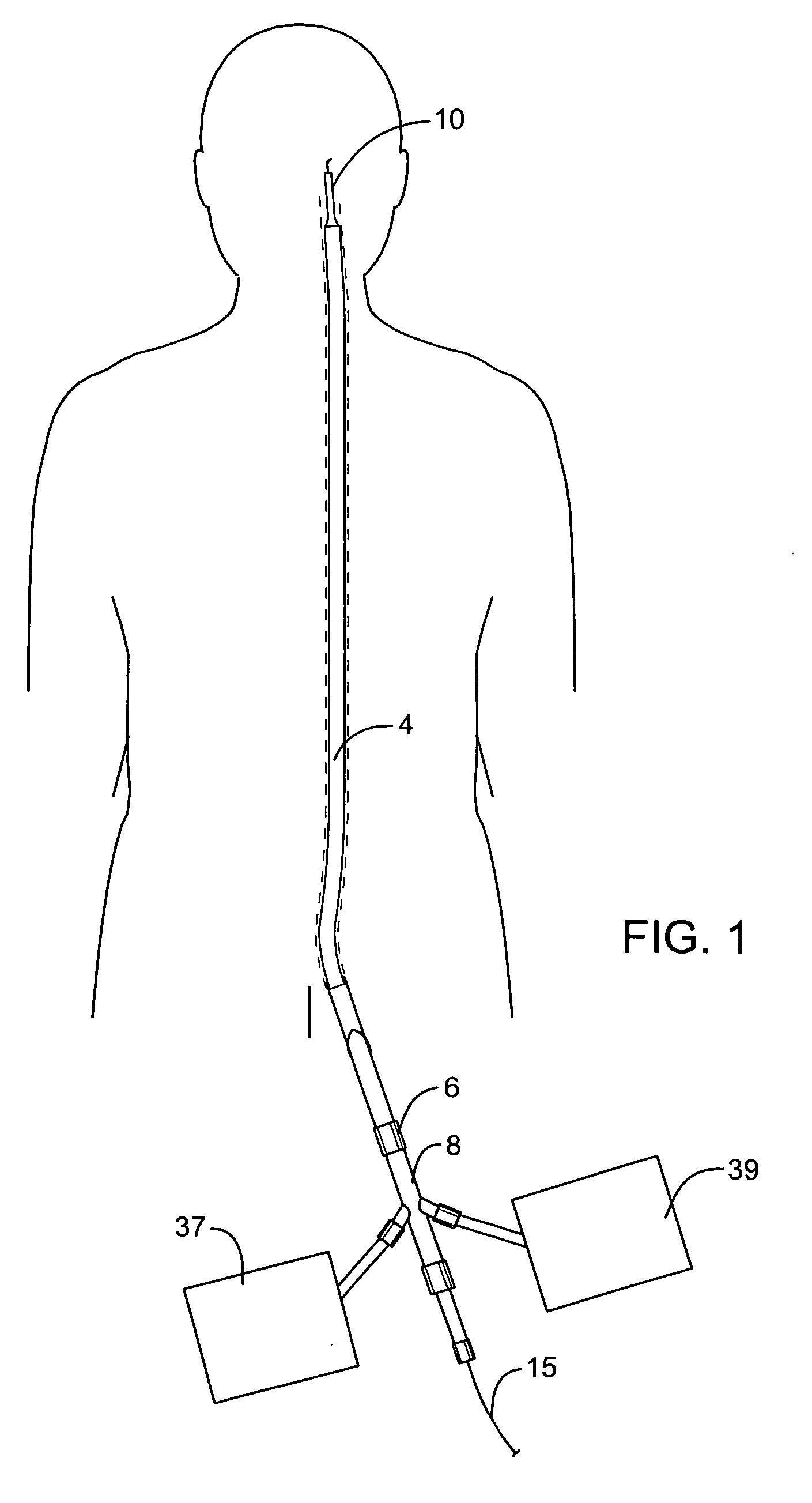 Methods and devices for protecting passageway in a body when advancing devices through the passageway