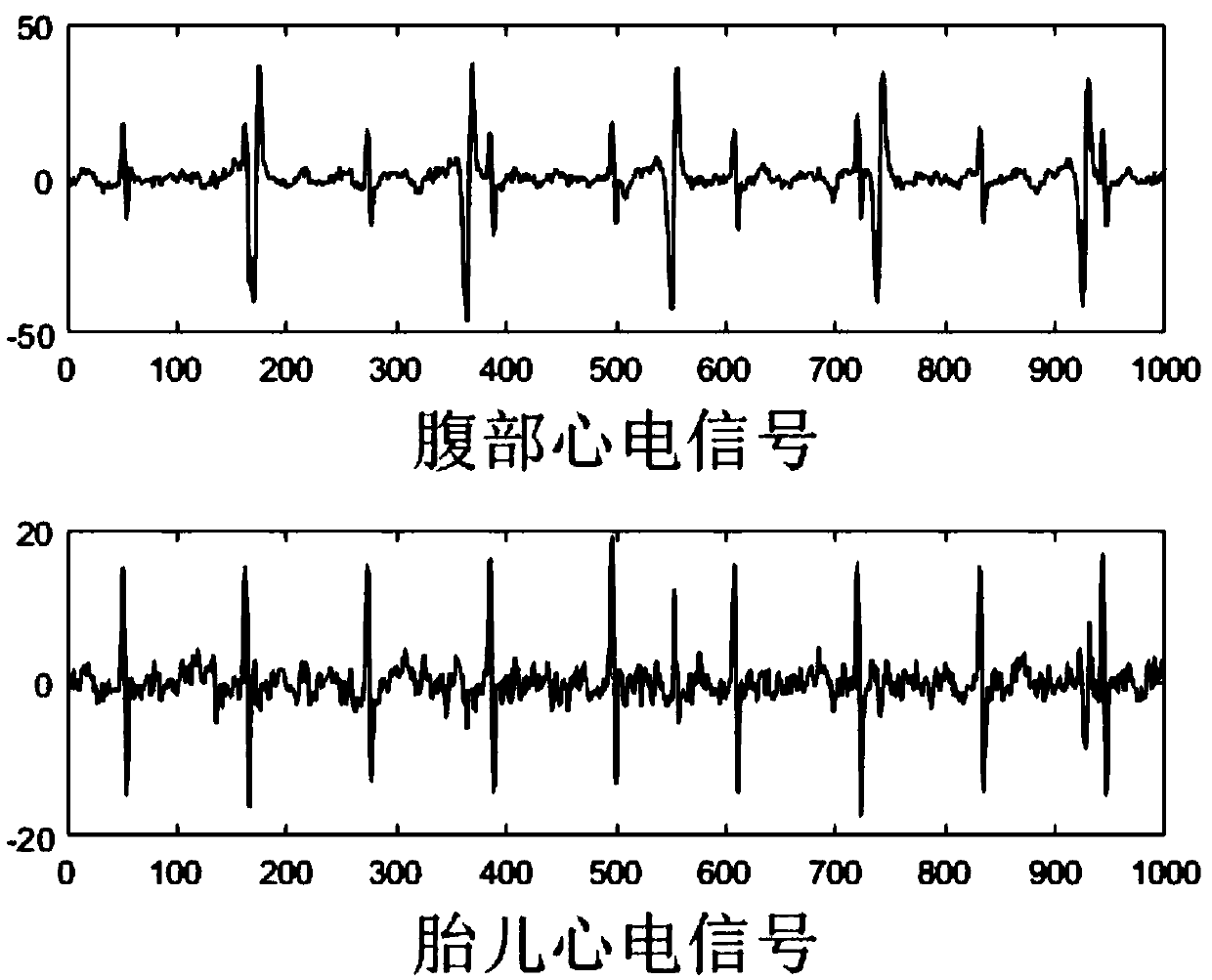 Single channel abdominal recording fetal electrocardiogram extraction method