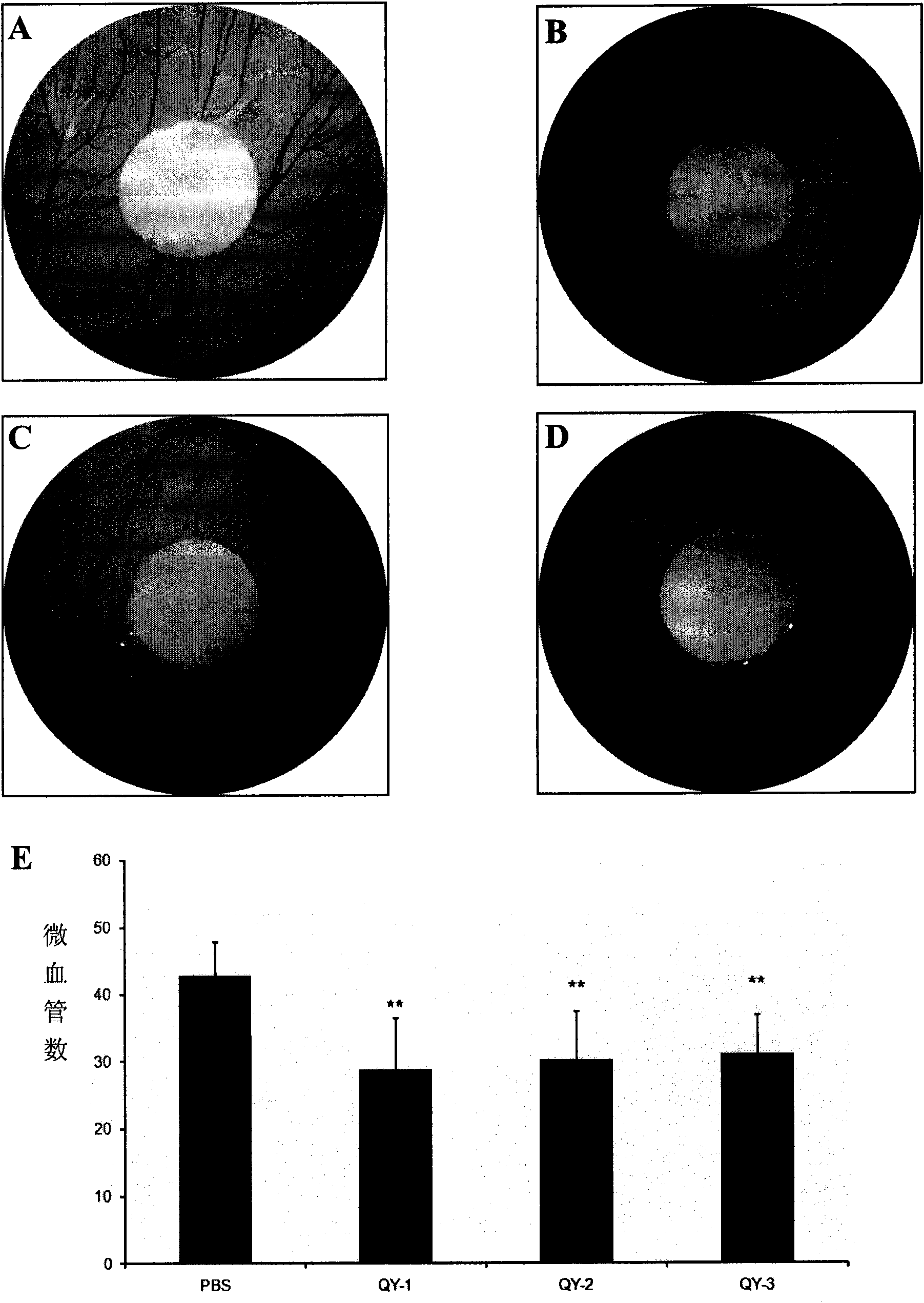 Polypeptide for preventing and treating angiogenesis and application thereof