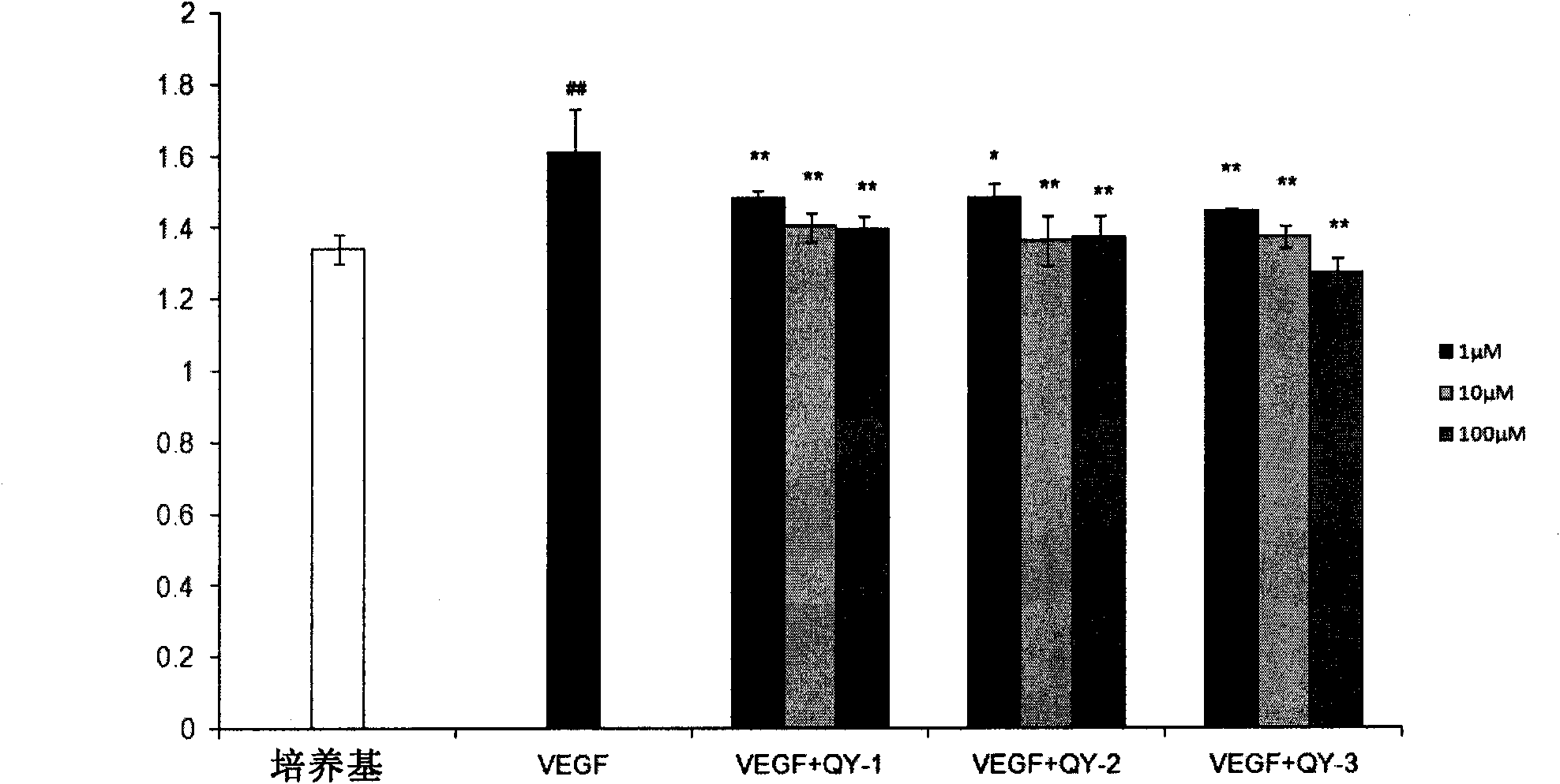 Polypeptide for preventing and treating angiogenesis and application thereof