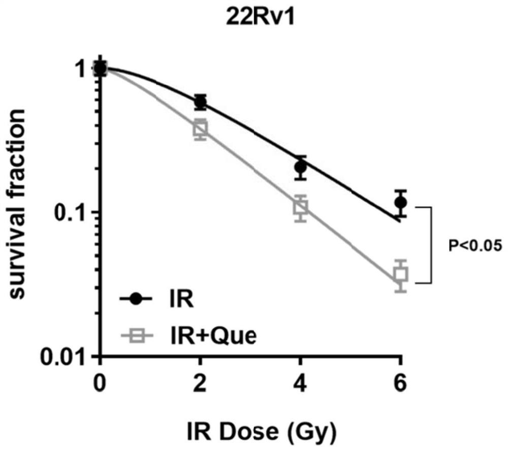 Application of quercetin in preparation of prostate cancer radiotherapy sensitizing drug