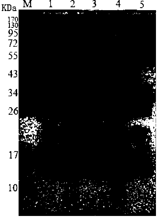 Brucella bp26 protein epitope, monoclonal antibody and application thereof