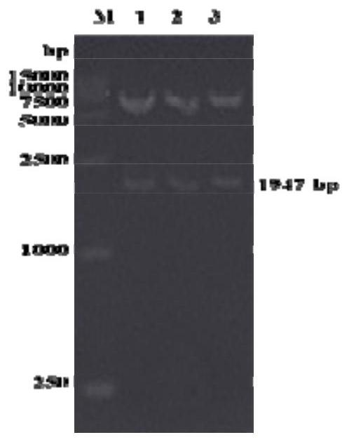 Sheep triple anti-subunit vaccine and preparation method thereof