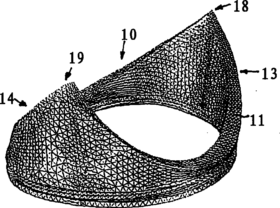 Prosthetic mitral heart valve