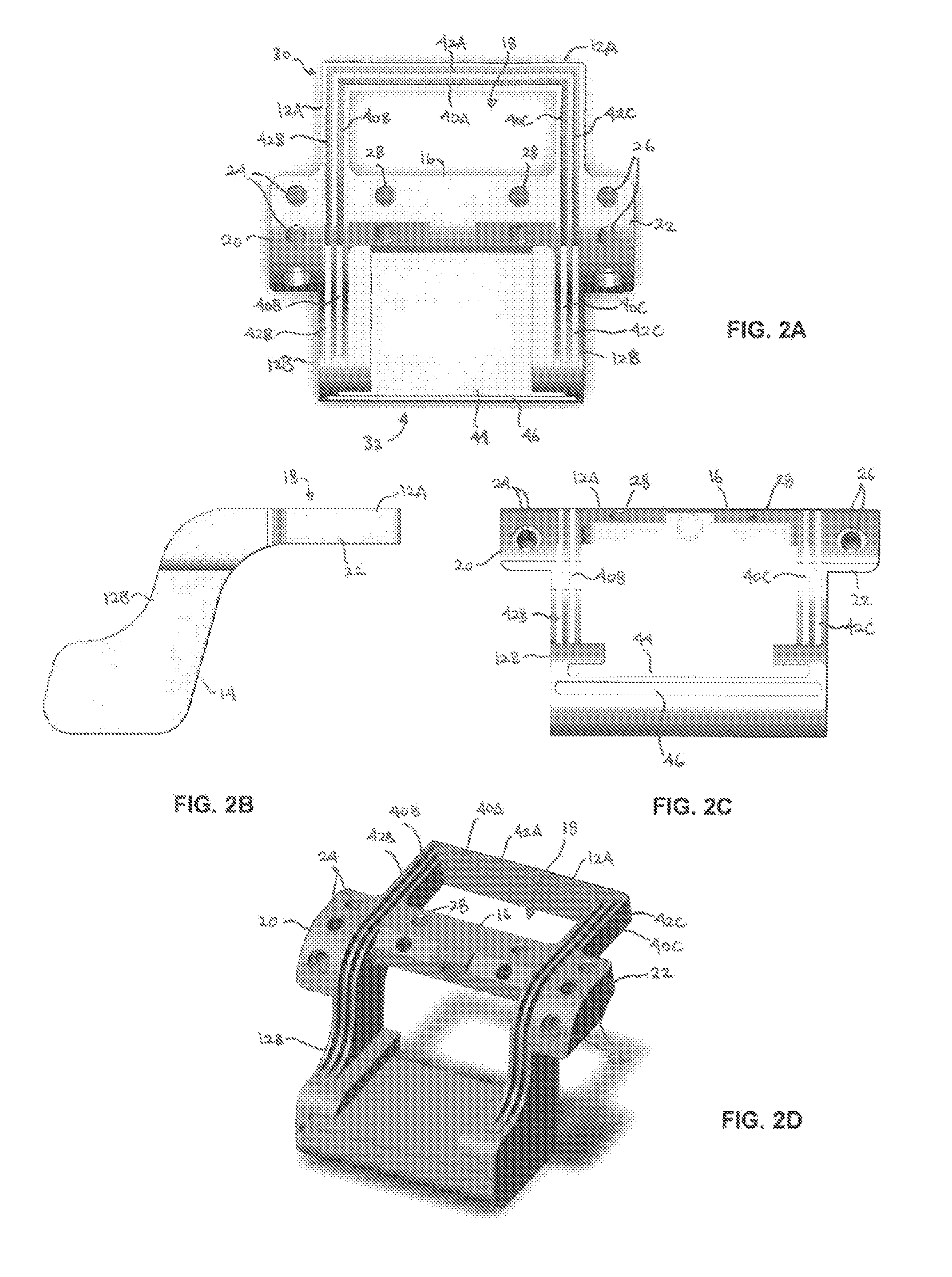 Allograft templates and methods of use
