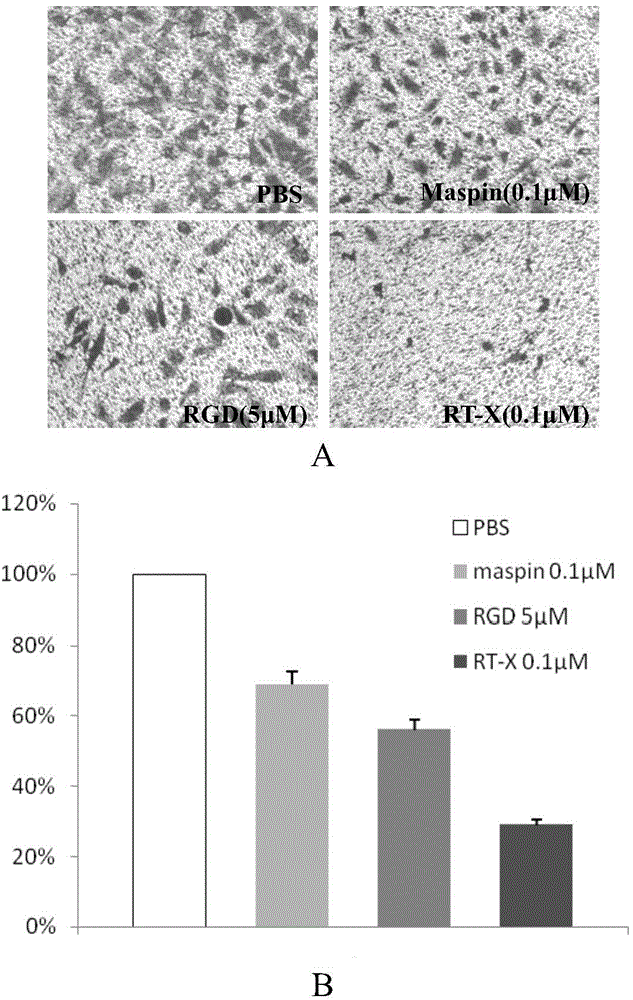 Method for producing antiangiogenesis agent RT-X in colibacillus and application of antiangiogenesis agent RT-X