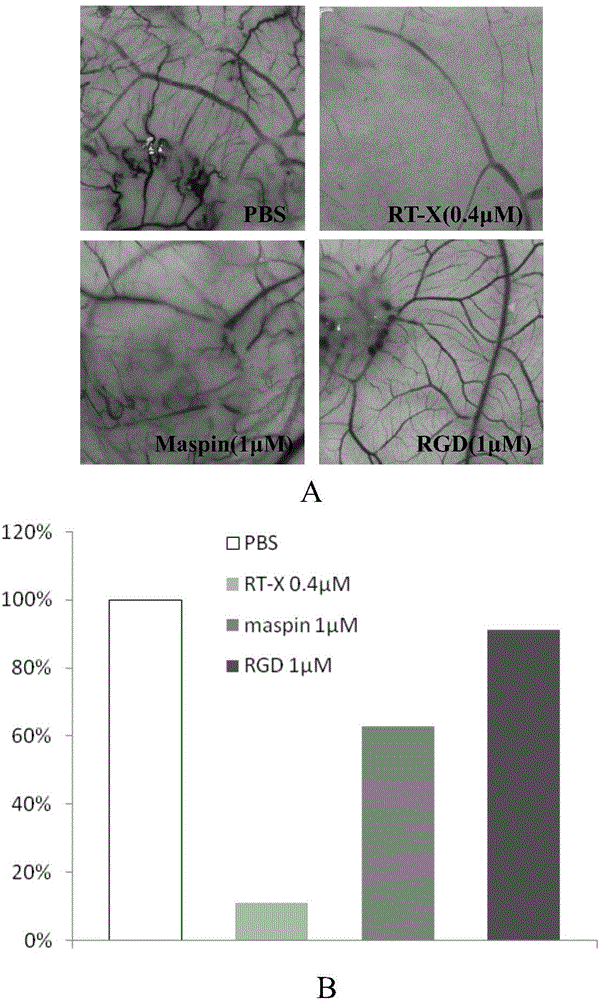 Method for producing antiangiogenesis agent RT-X in colibacillus and application of antiangiogenesis agent RT-X