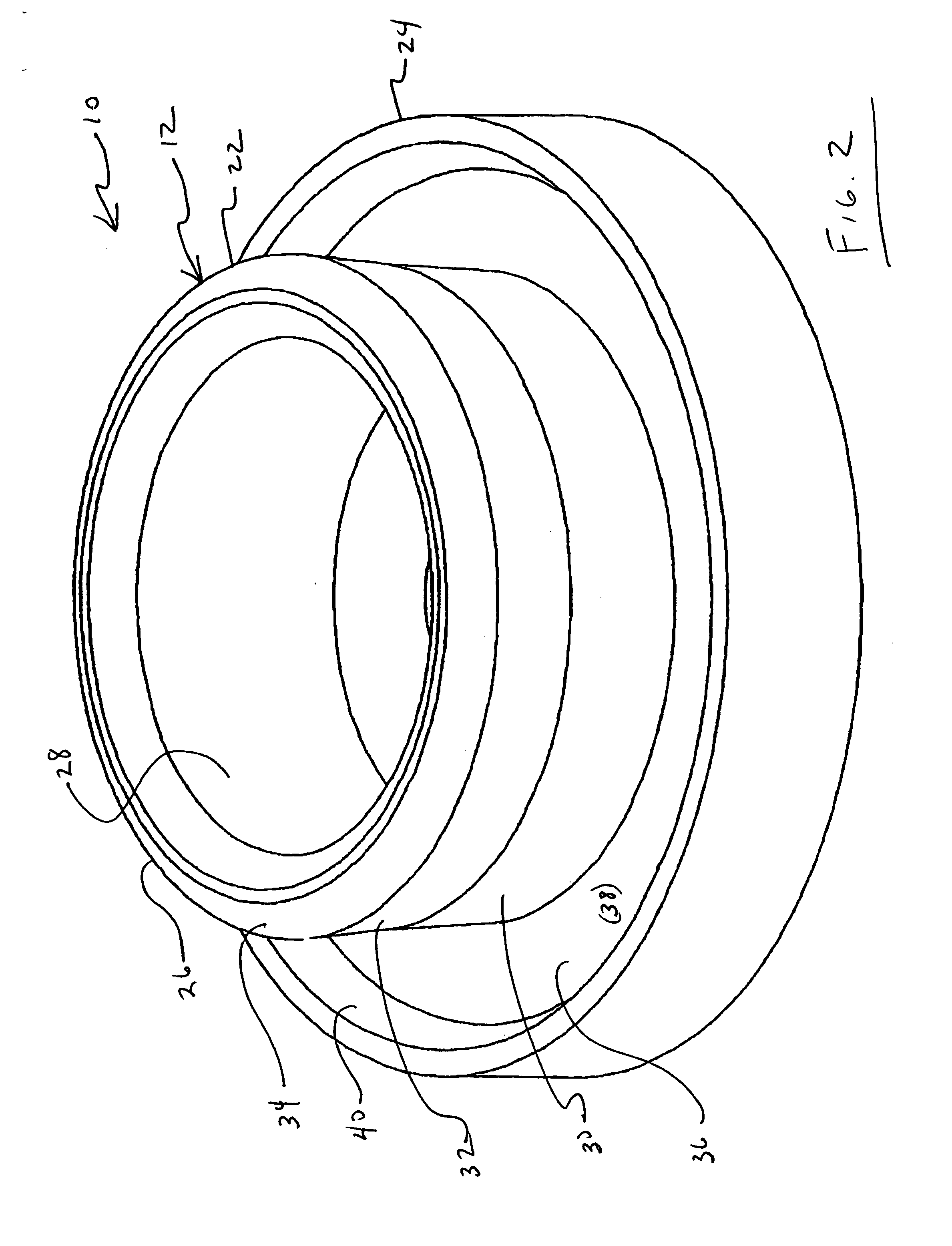 Snap fastener