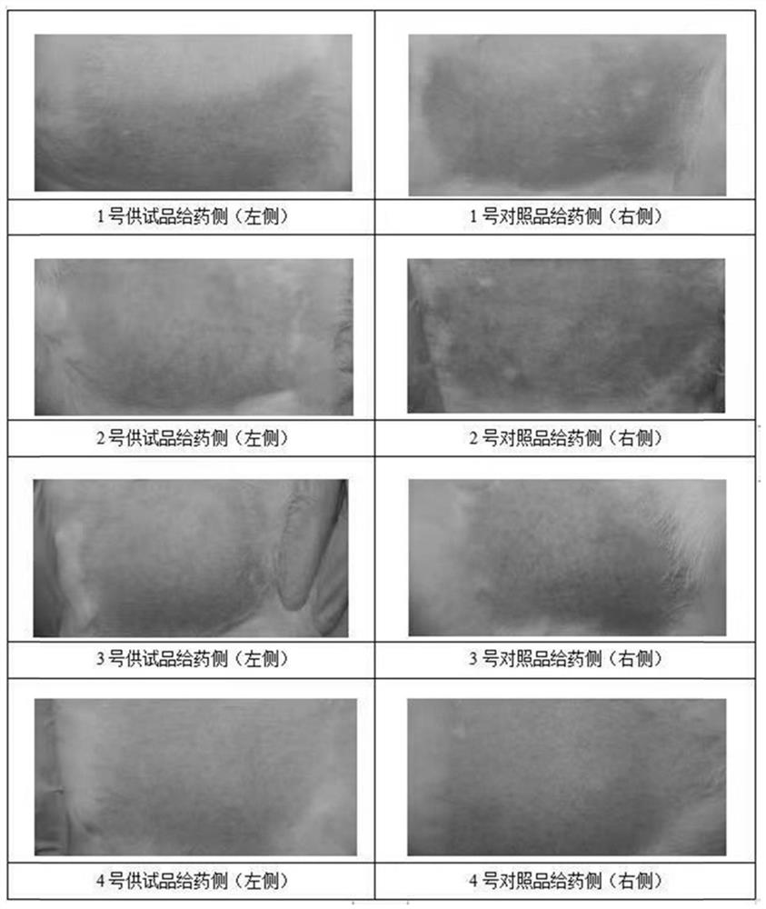 Pharmaceutical composition containing pharmaceutically acceptable salt of tofacitinib, preparation and application