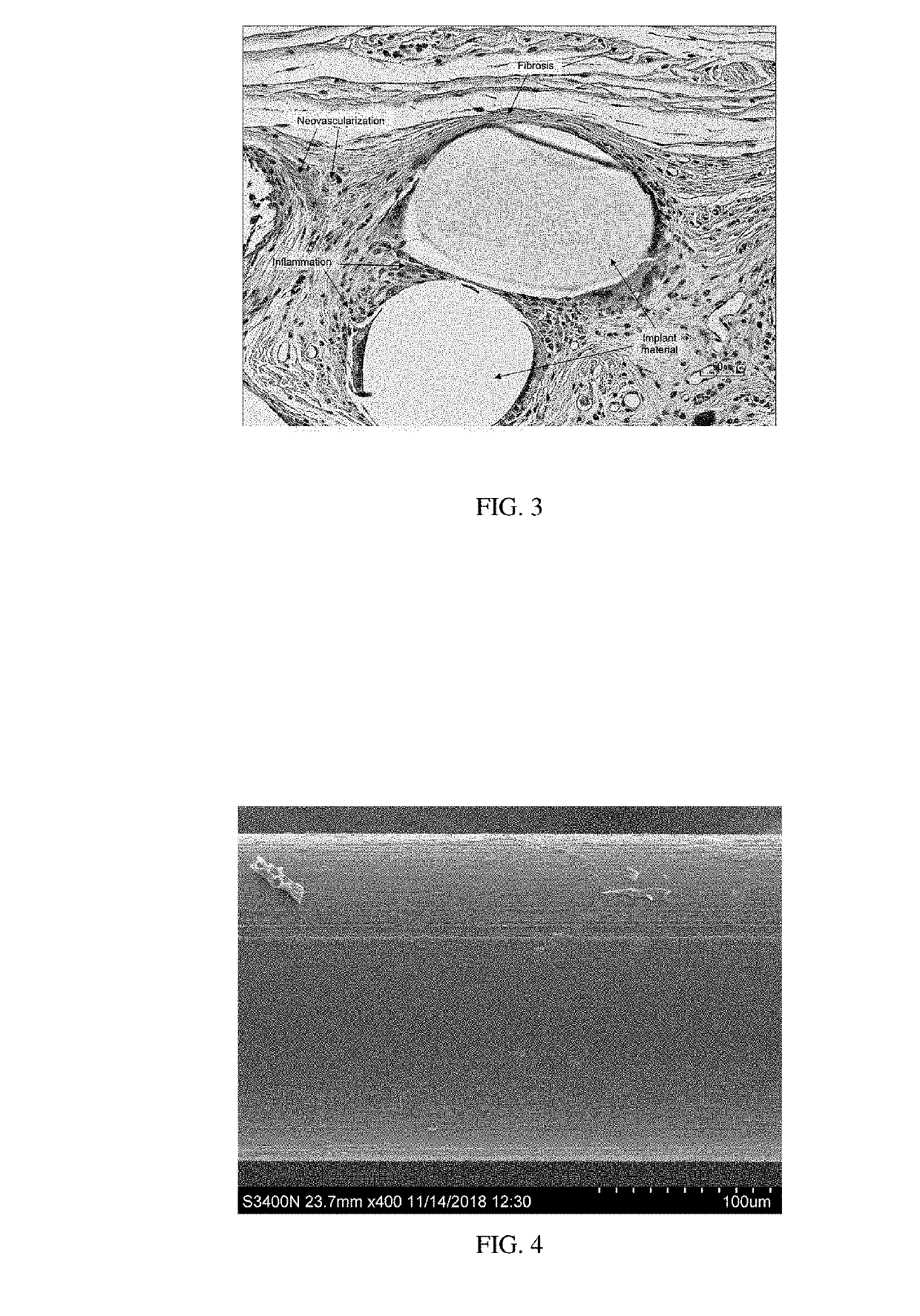 Yarns and fibers of poly(butylene succinate) and copolymers thereof, and methods of use therof