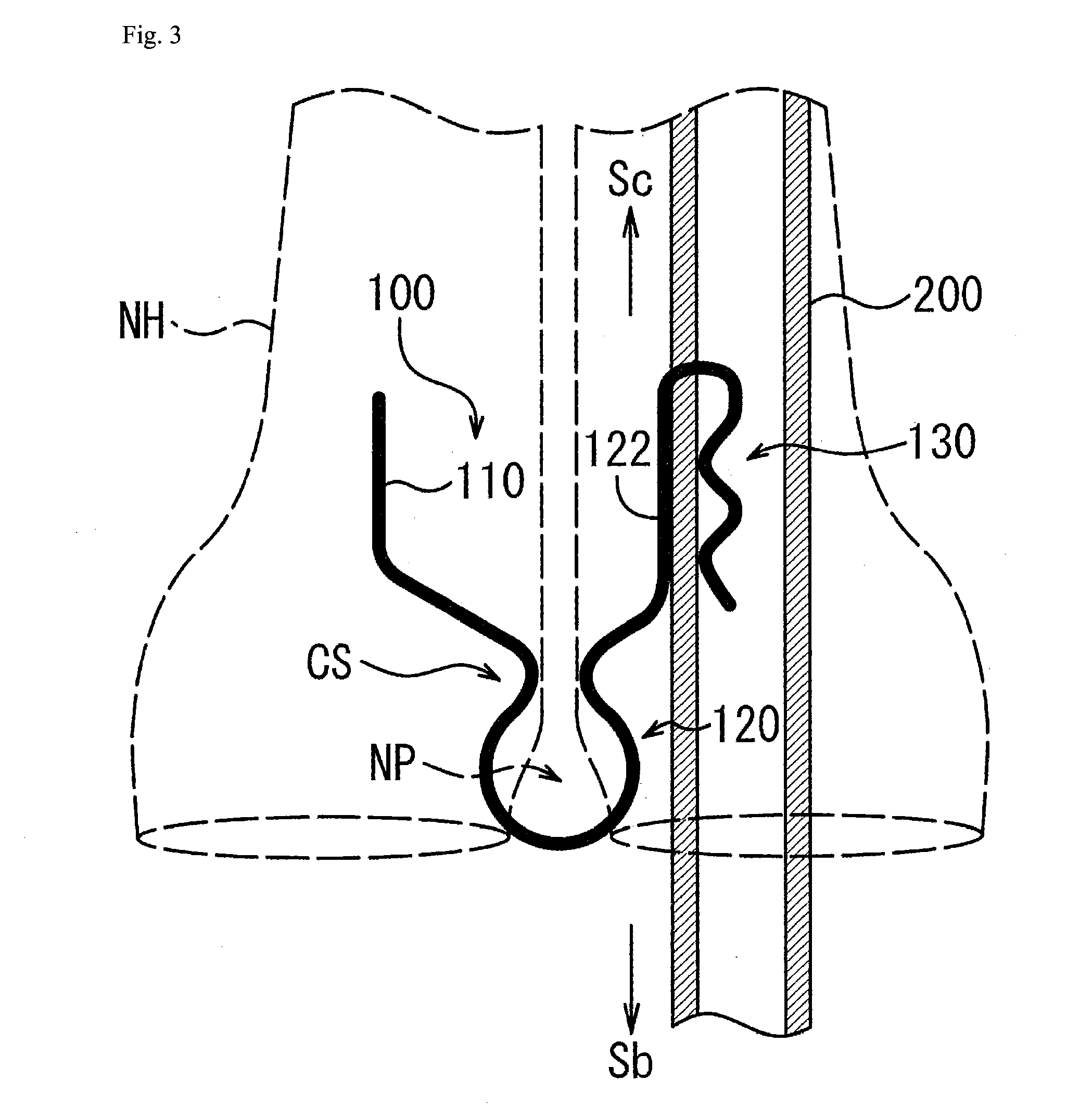 Nasal cavity insertion device fixture and nasal cavity insertion device set including the same