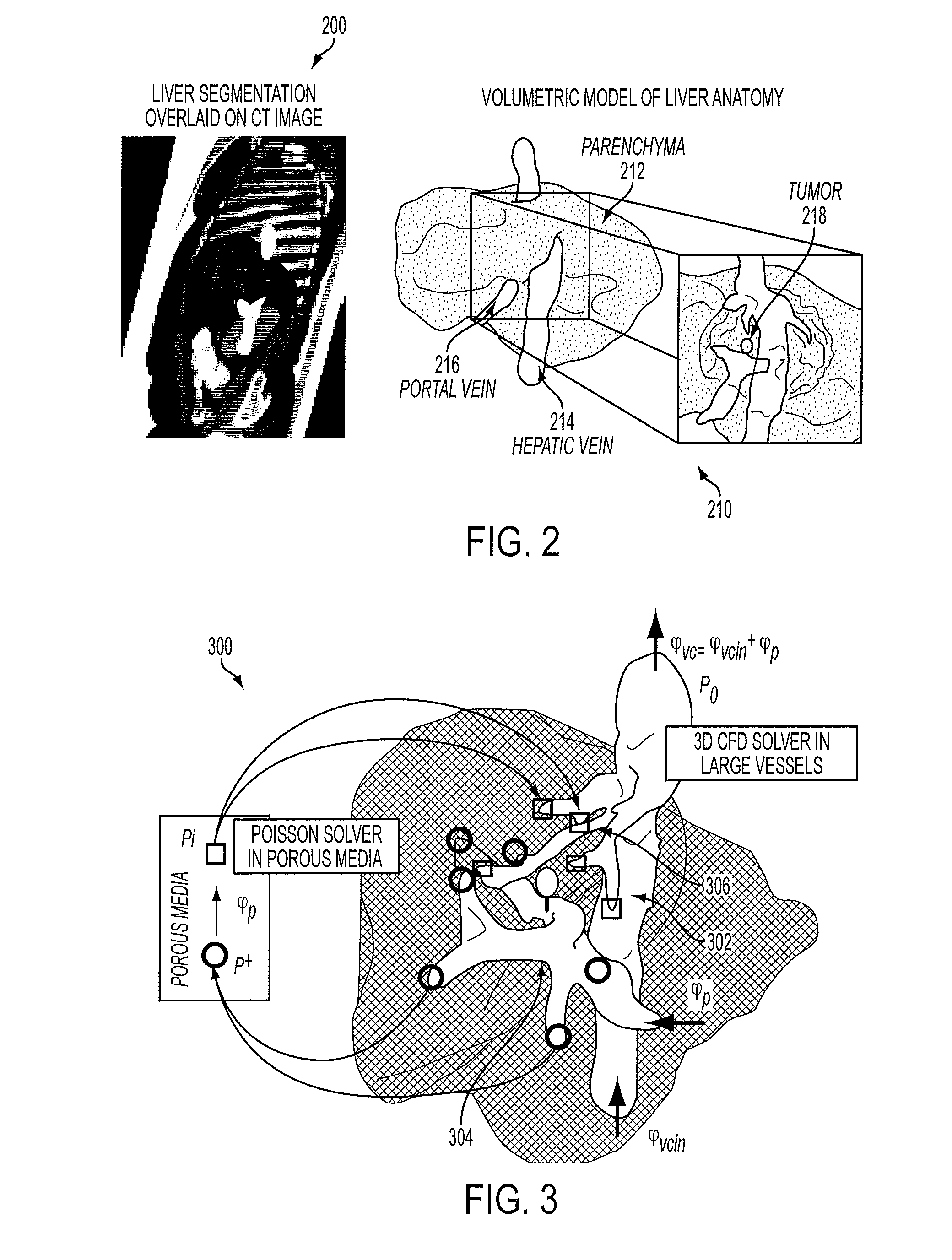 System And Method For Interactive Patient Specific Simulation Of Radiofrequency Ablation Therapy