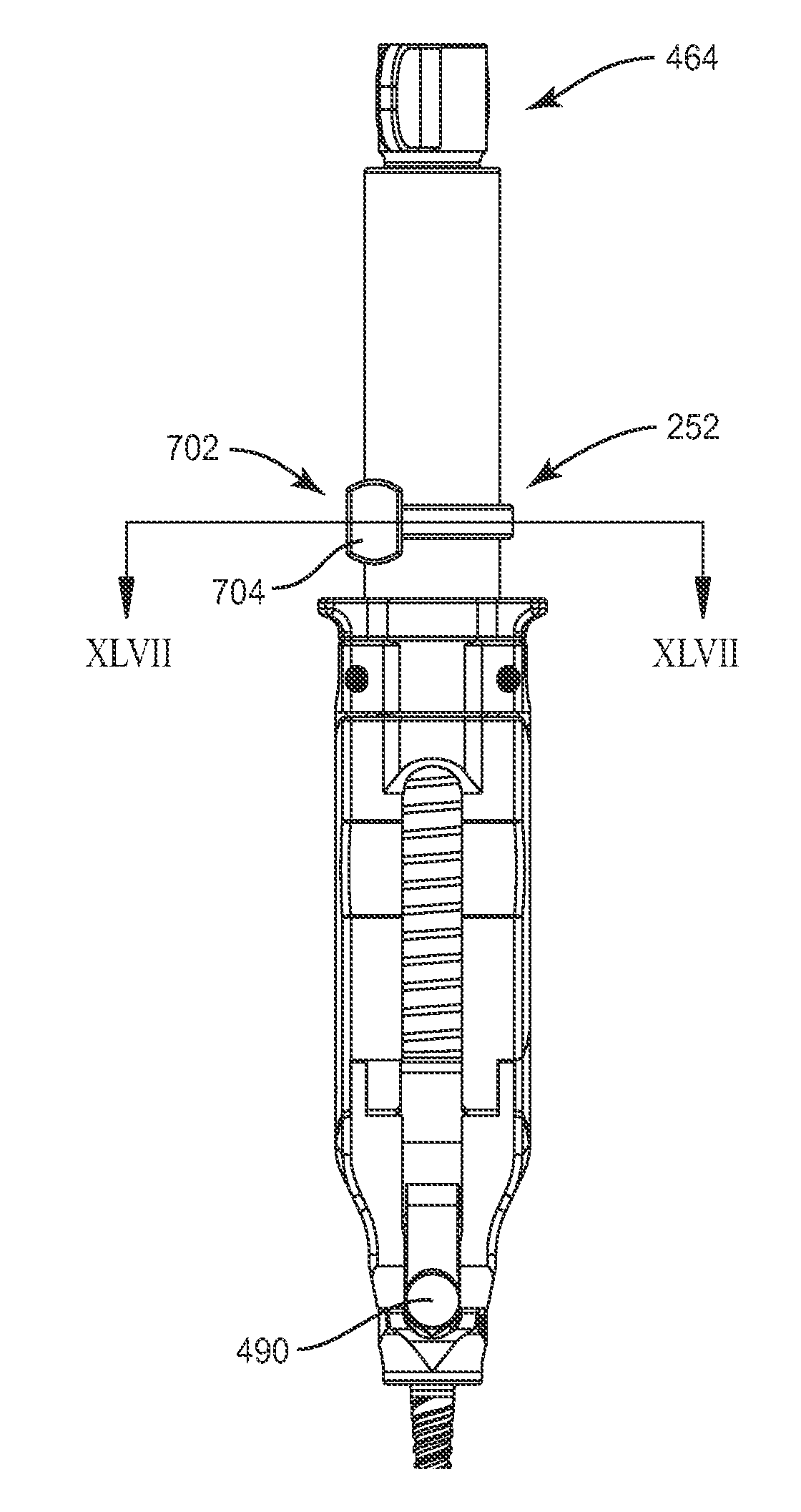 Spinal rod system and method