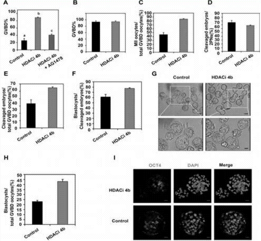Immature oocyte in-vitro maturation culture solution and application thereof