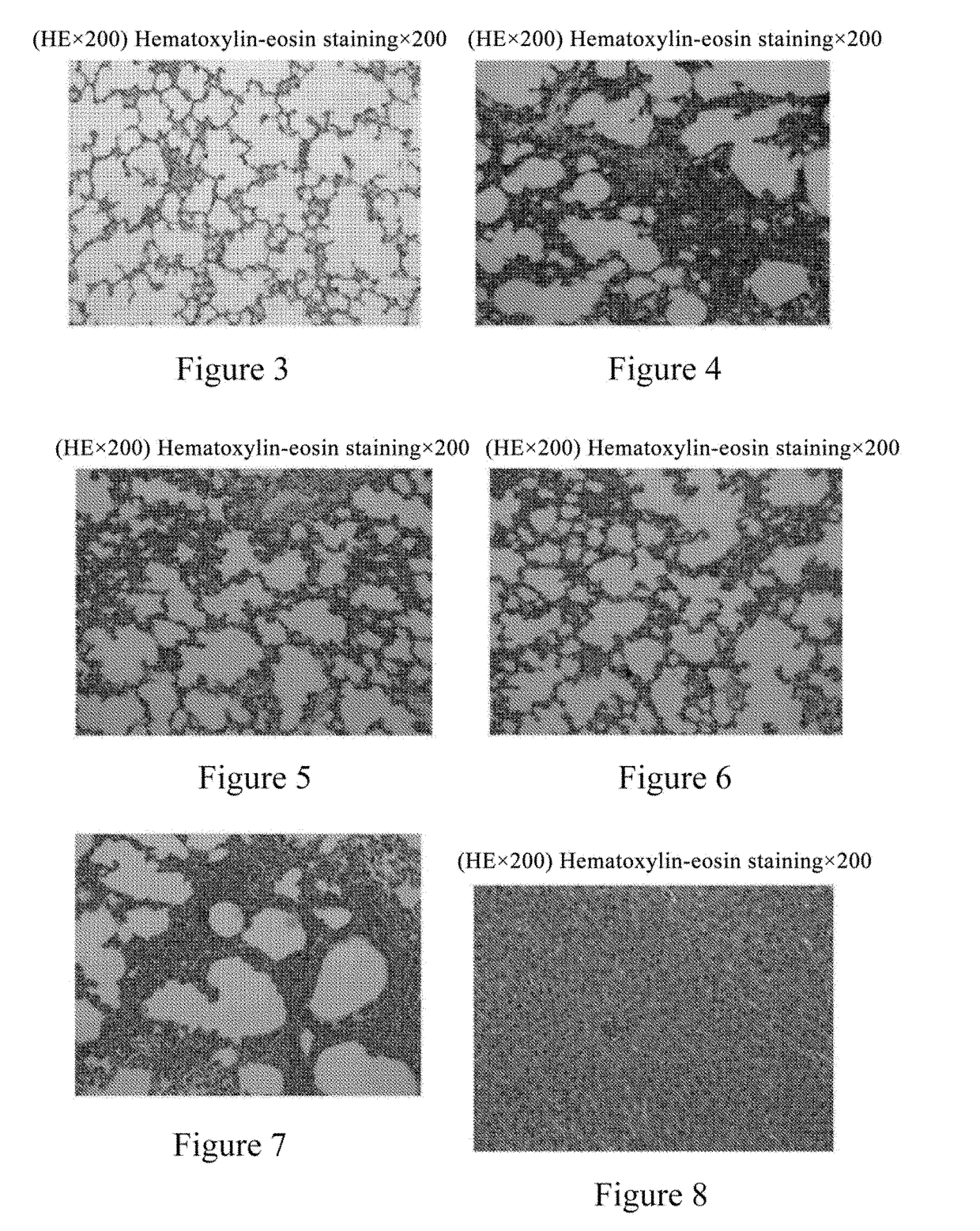 Application of pirenzepine for treating sepsis