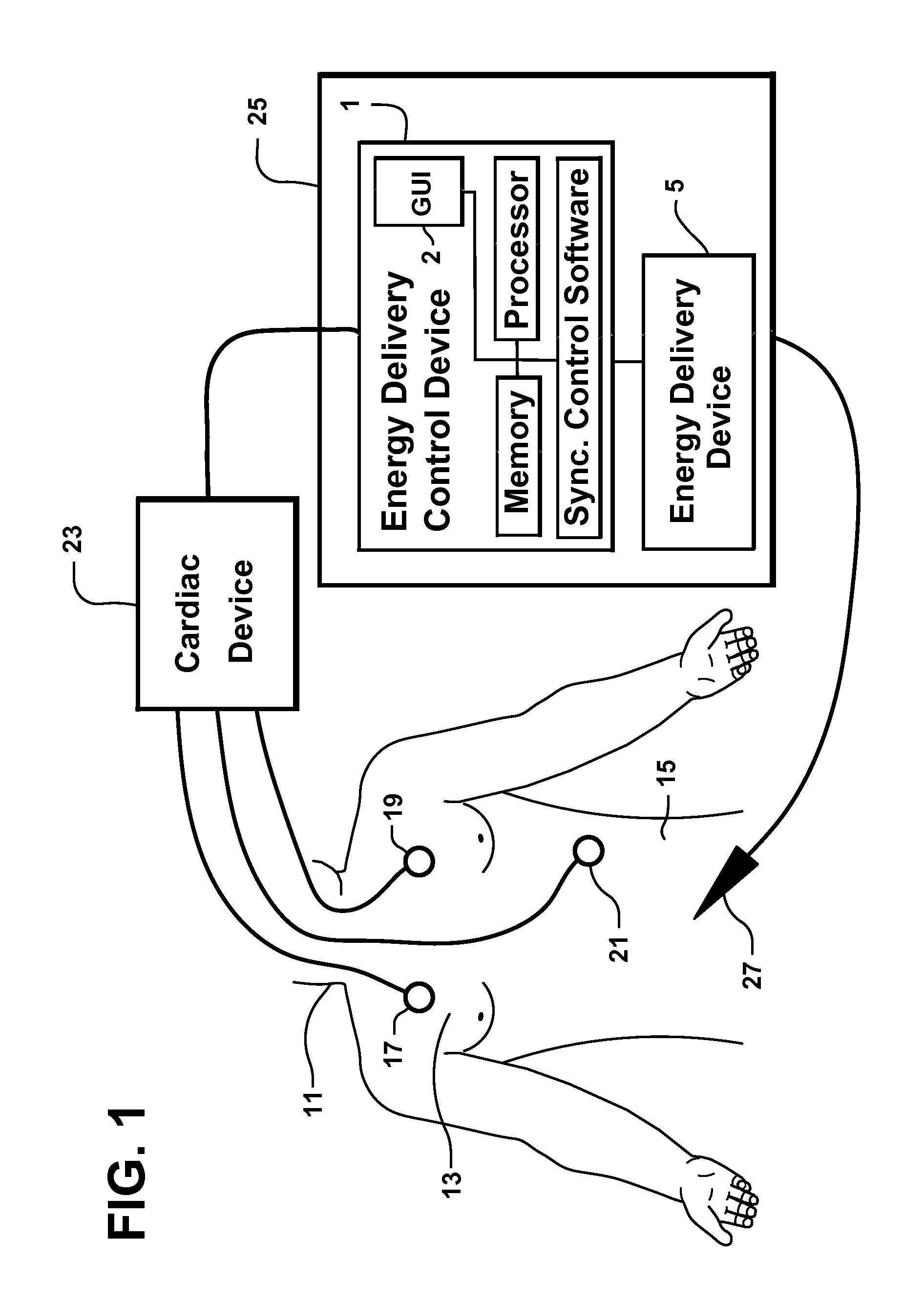 System and method for synchronizing energy delivery to the cardiac rhythm