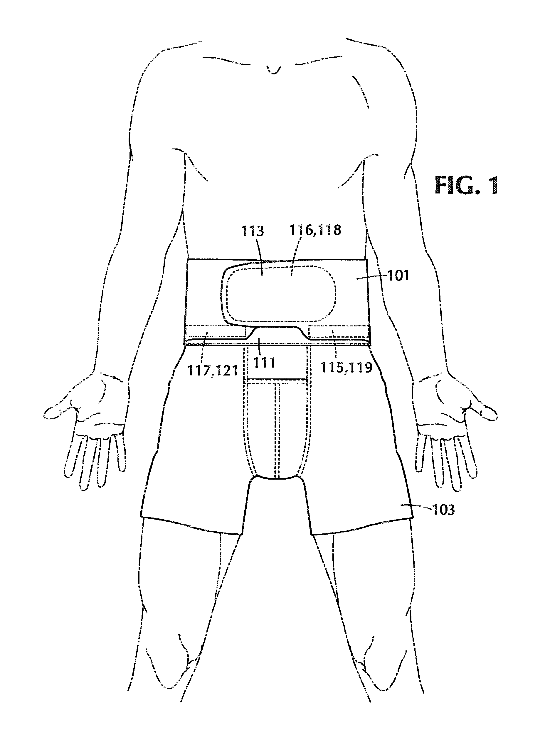 Back support garment apparatus