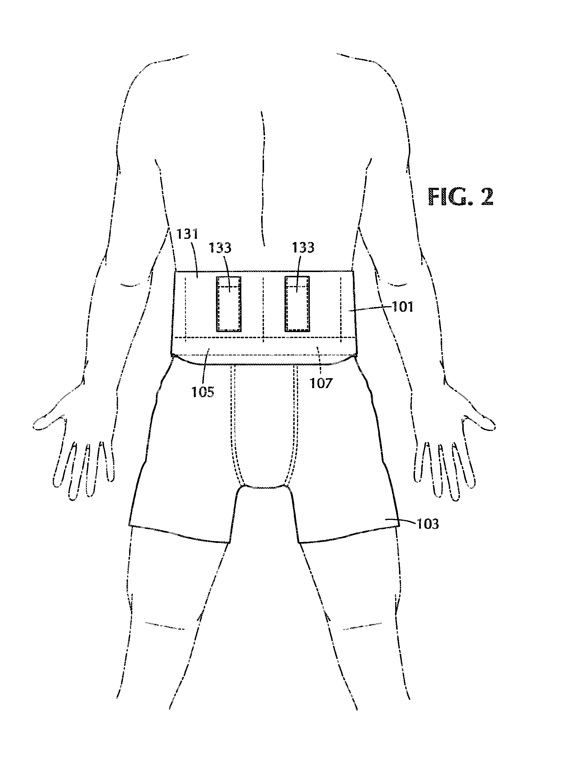 Back support garment apparatus