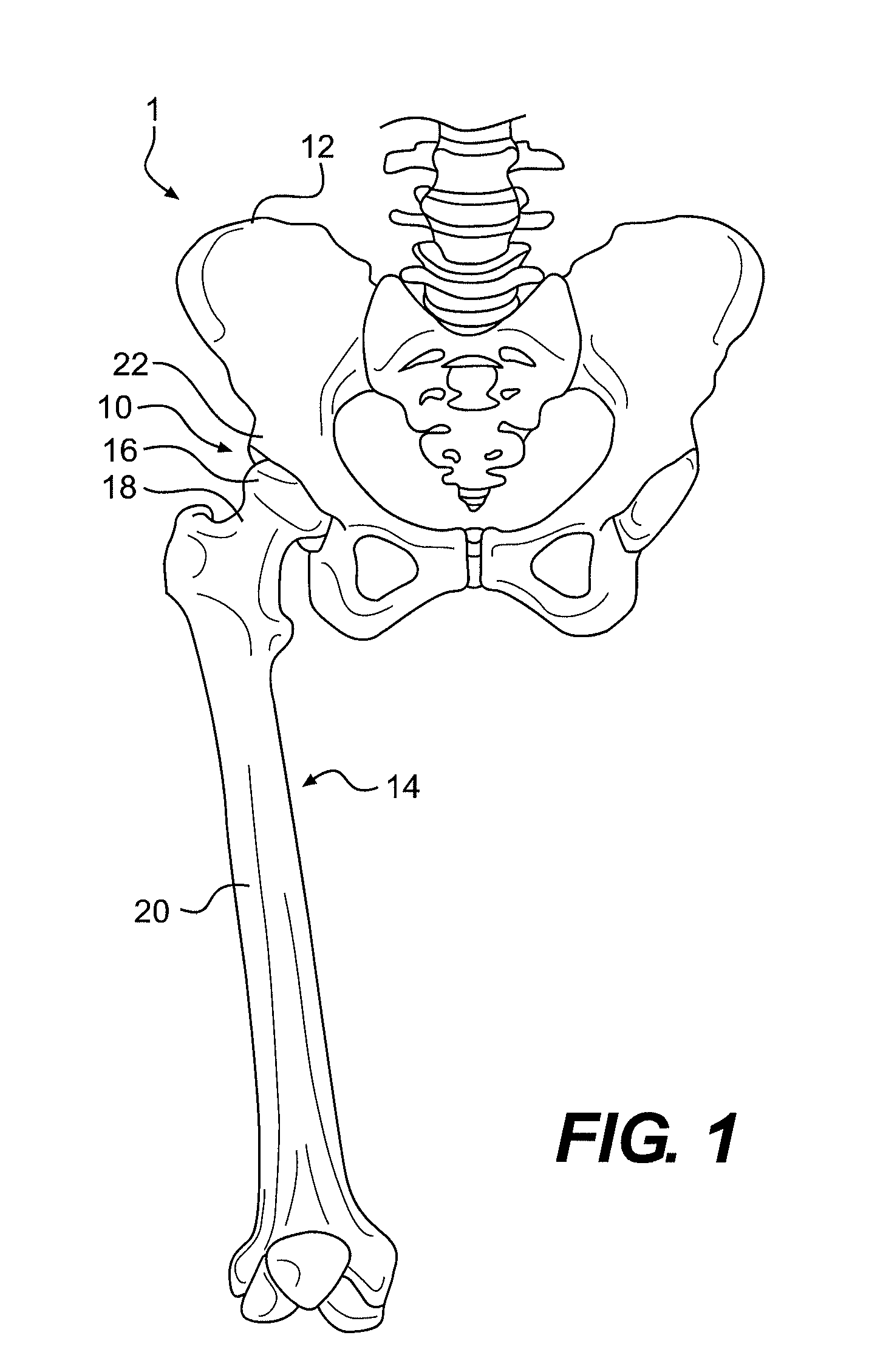 Systems and methods for measuring parameters in joint replacement surgery